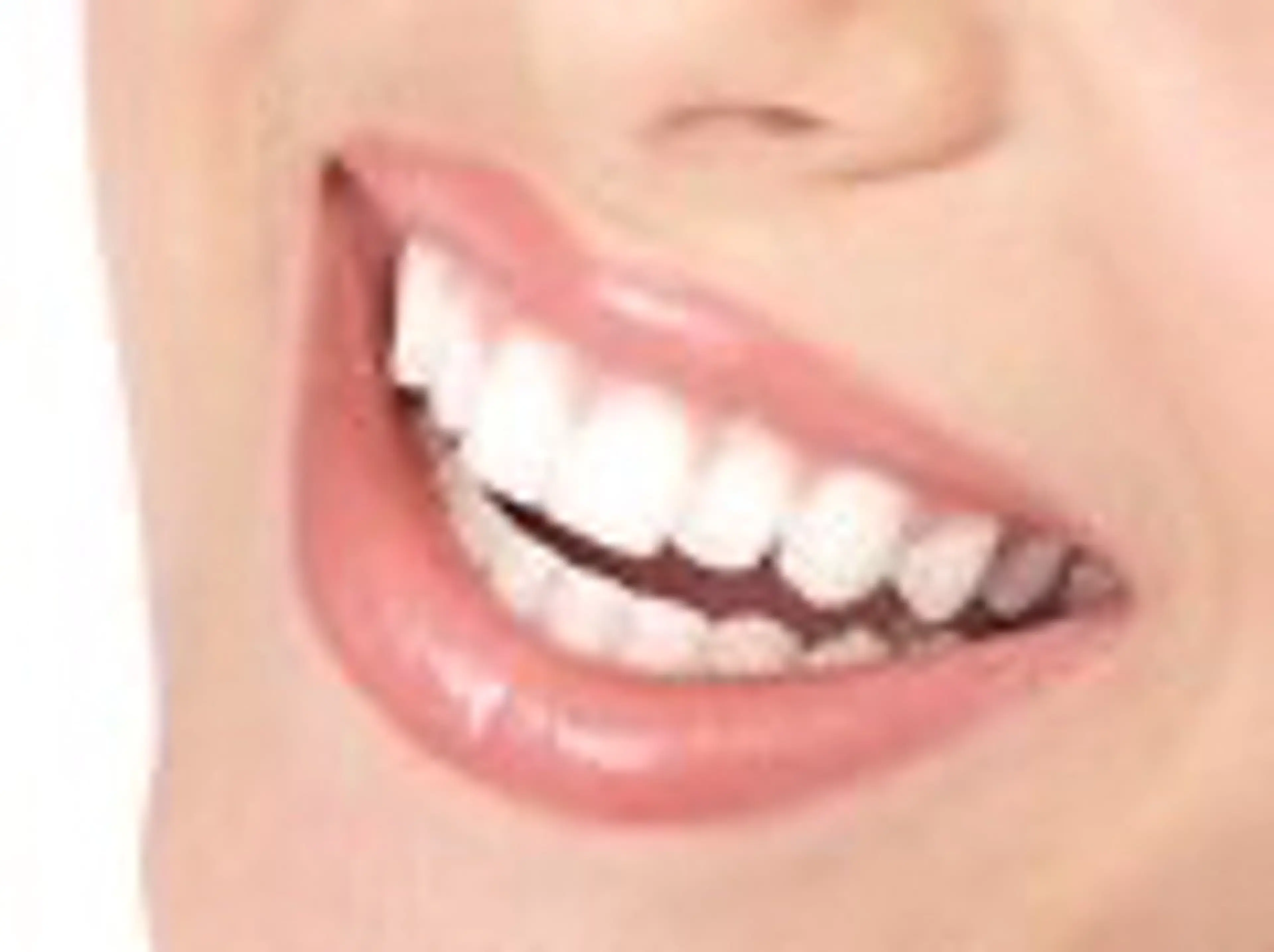 【🎁❤️minimo掲載記念🎁❤️】セルフホワイトニング初回体験(9分×2セット) 1回 ¥500の写真