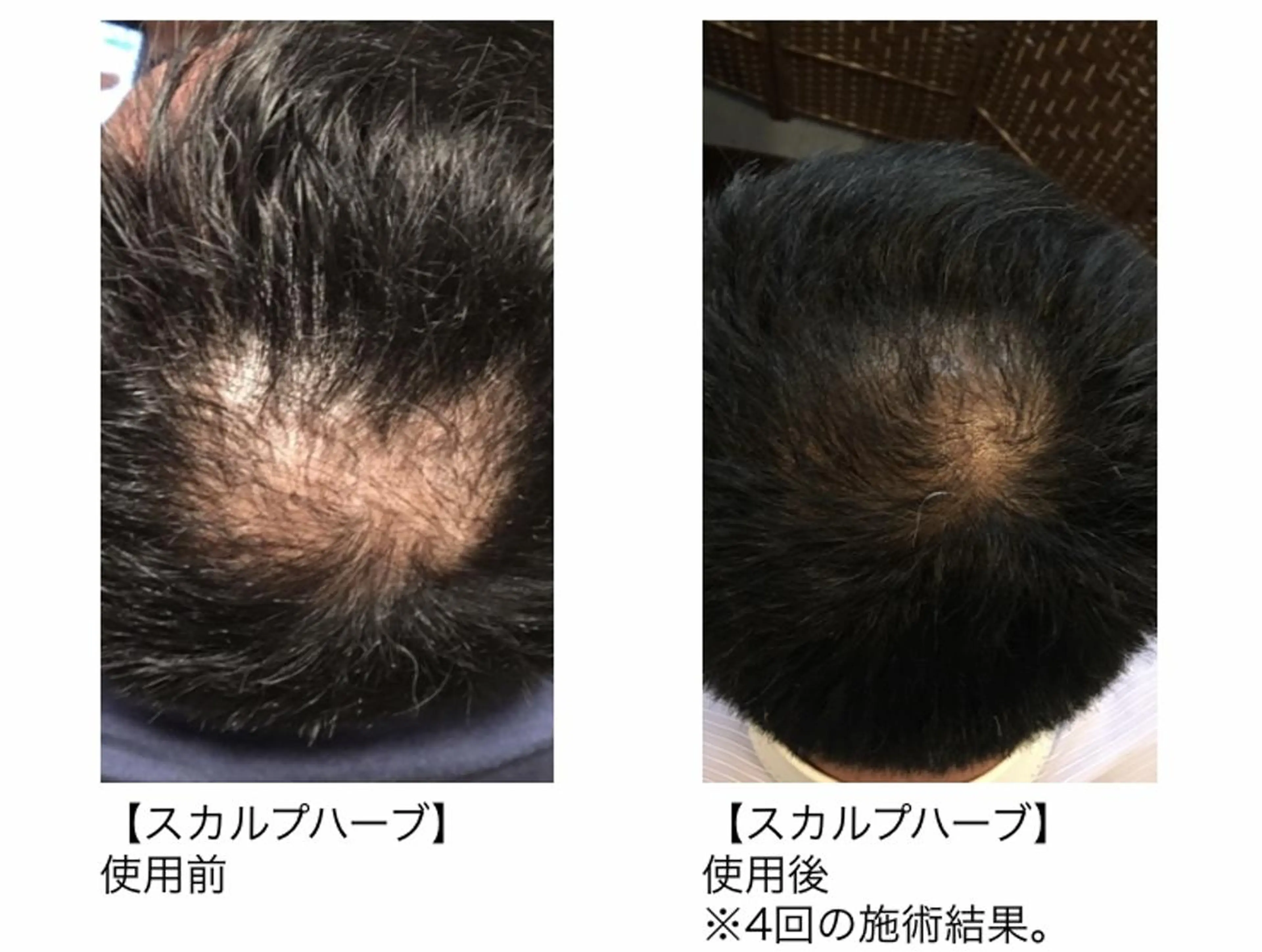 ヘアアレンジ メンズ BELLÉ TRINITYのエステ・リラクイメージ