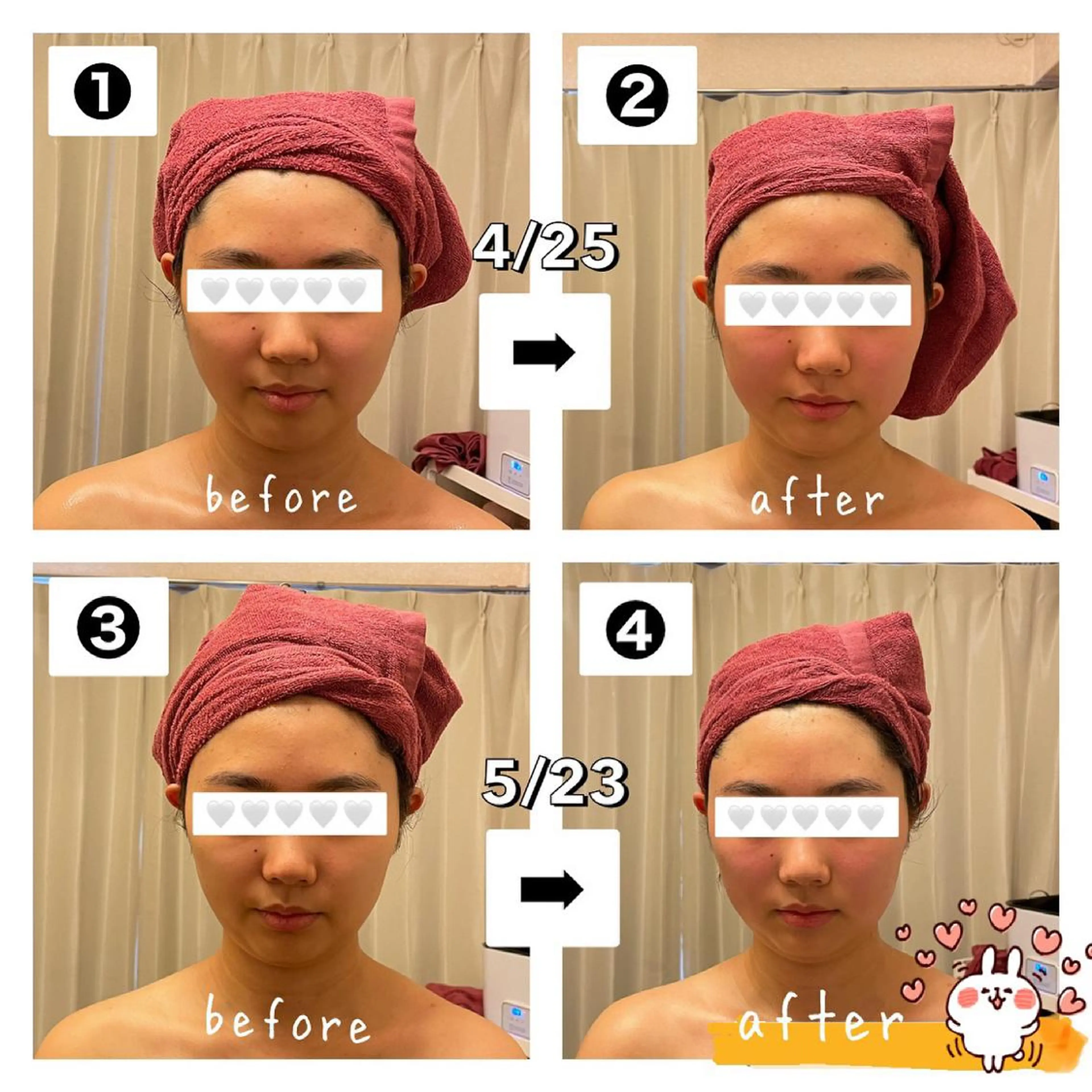 35歳からの エイジングケアサロンのエステ・リラクイメージ