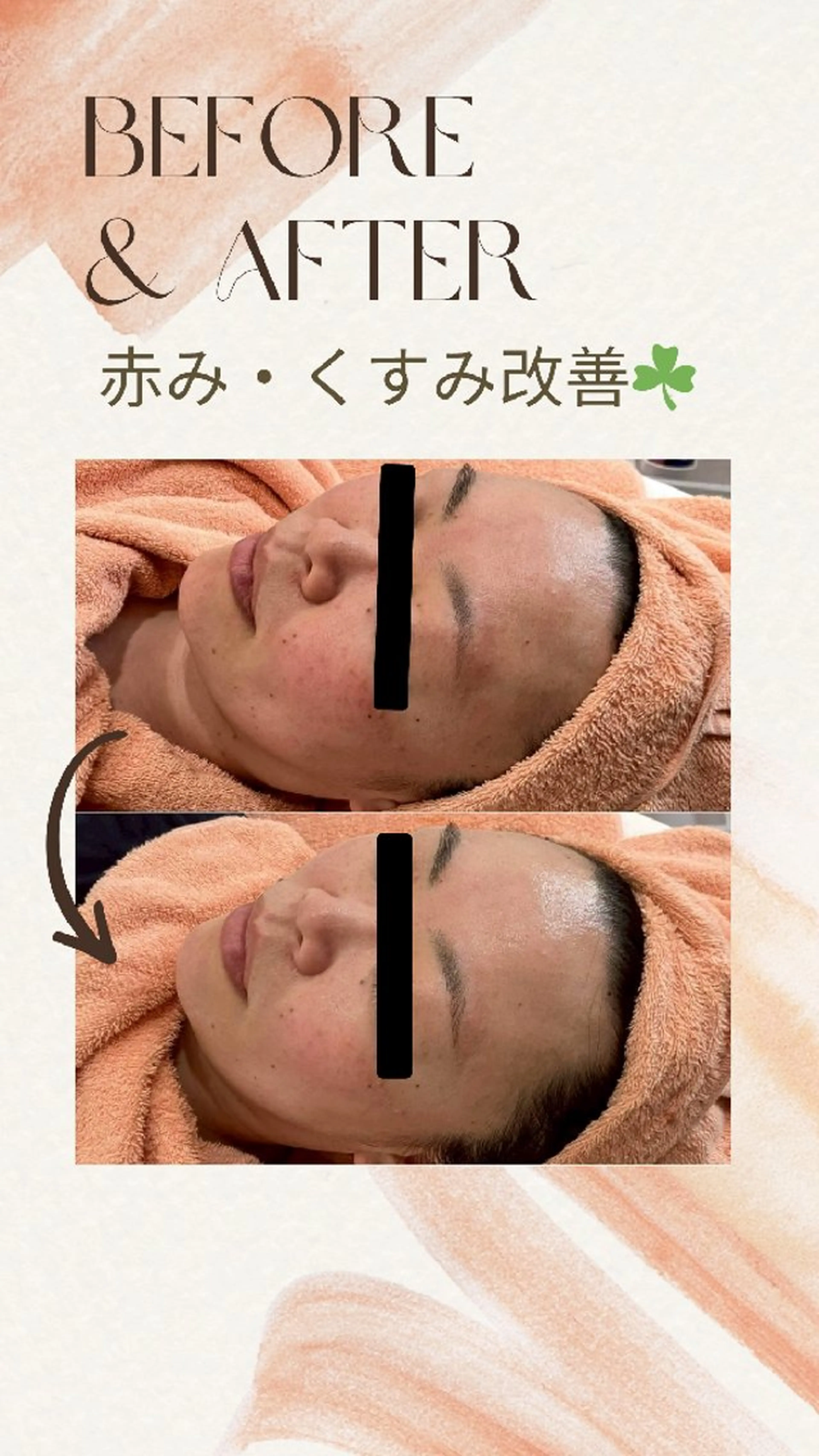 フェイシャル/御殿場 CSサロンAmuleのエステ・リラクイメージ