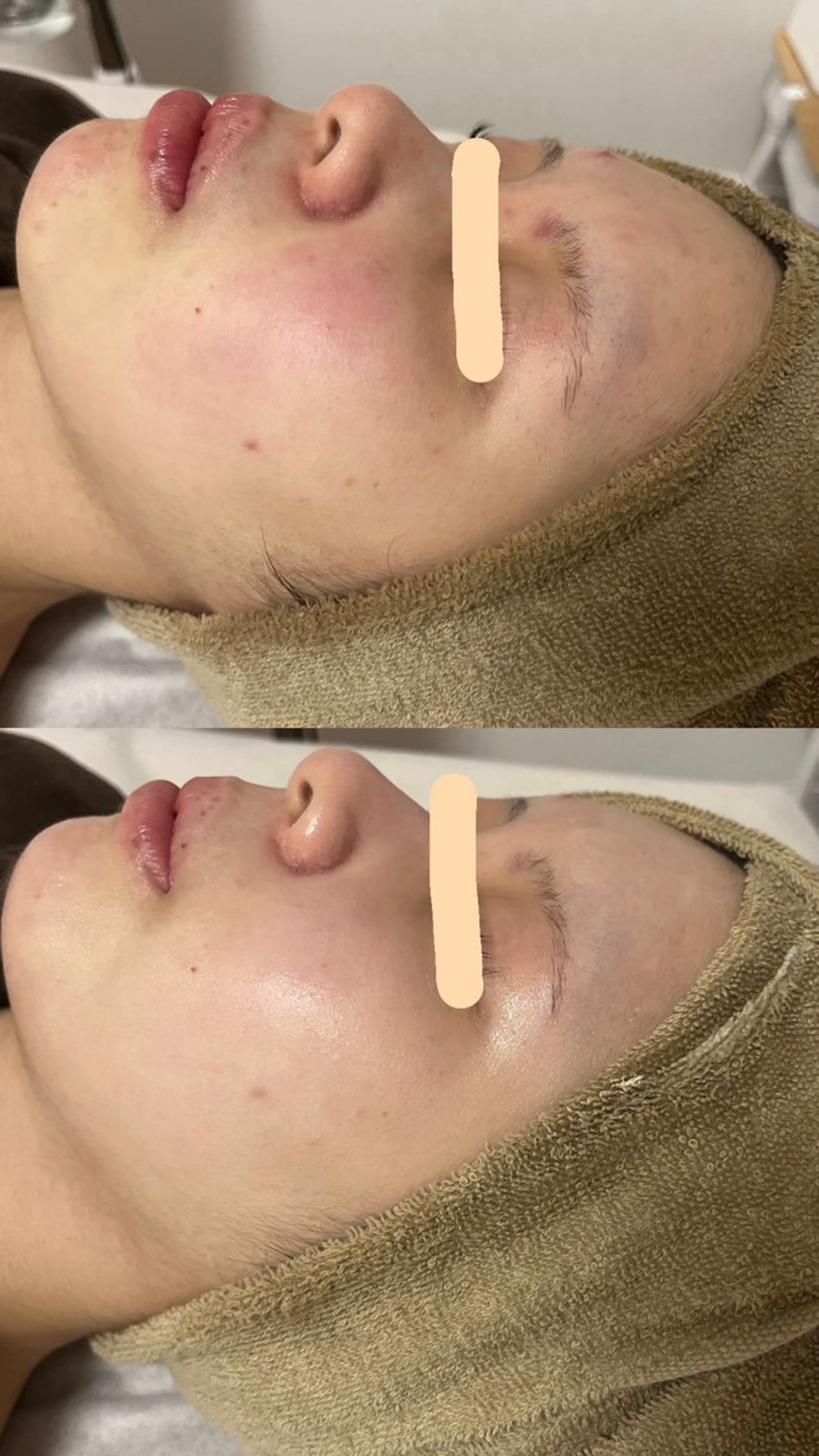 エステ 出口 玲菜のその他イメージ