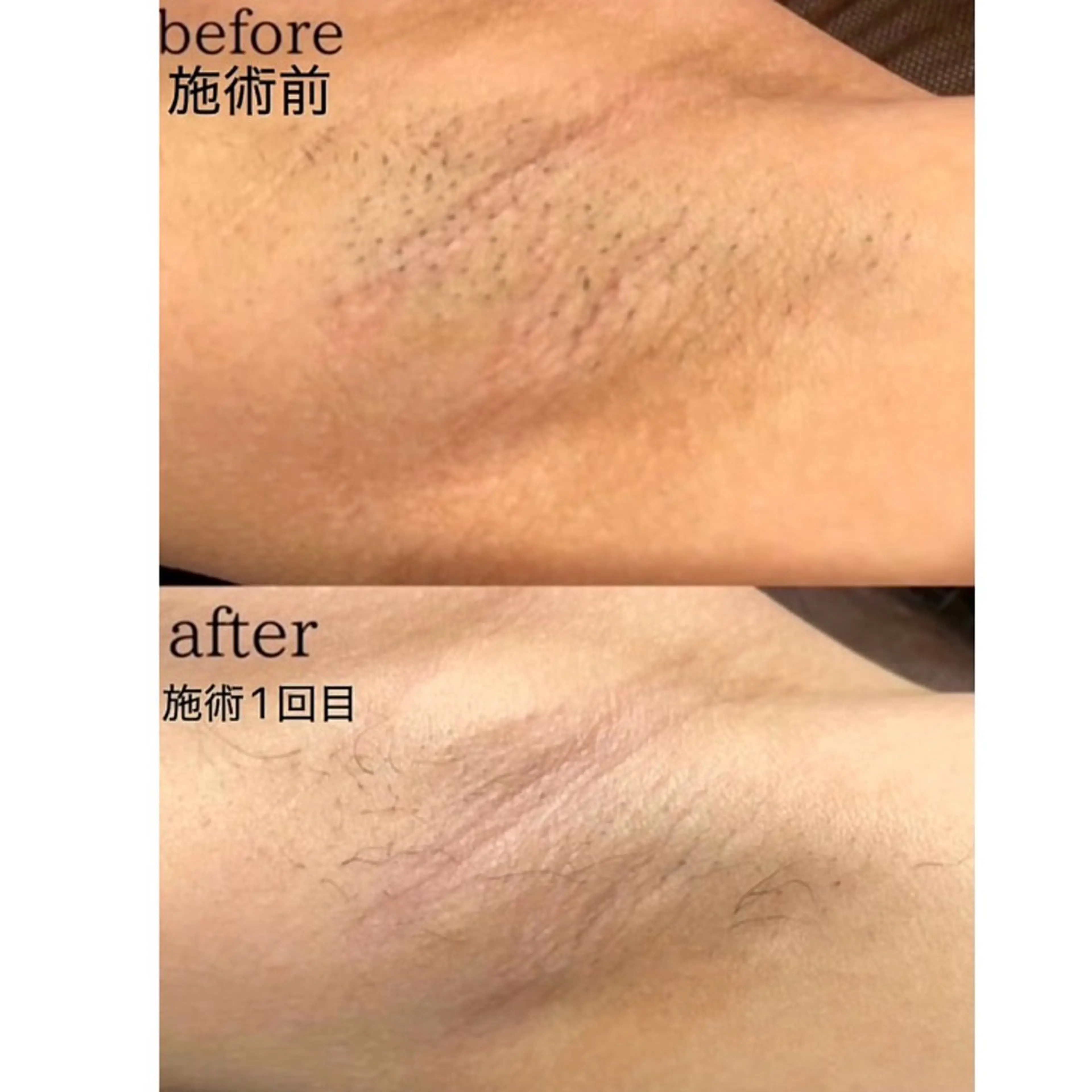 脱毛 KA PILINAのエステ・リラクイメージ