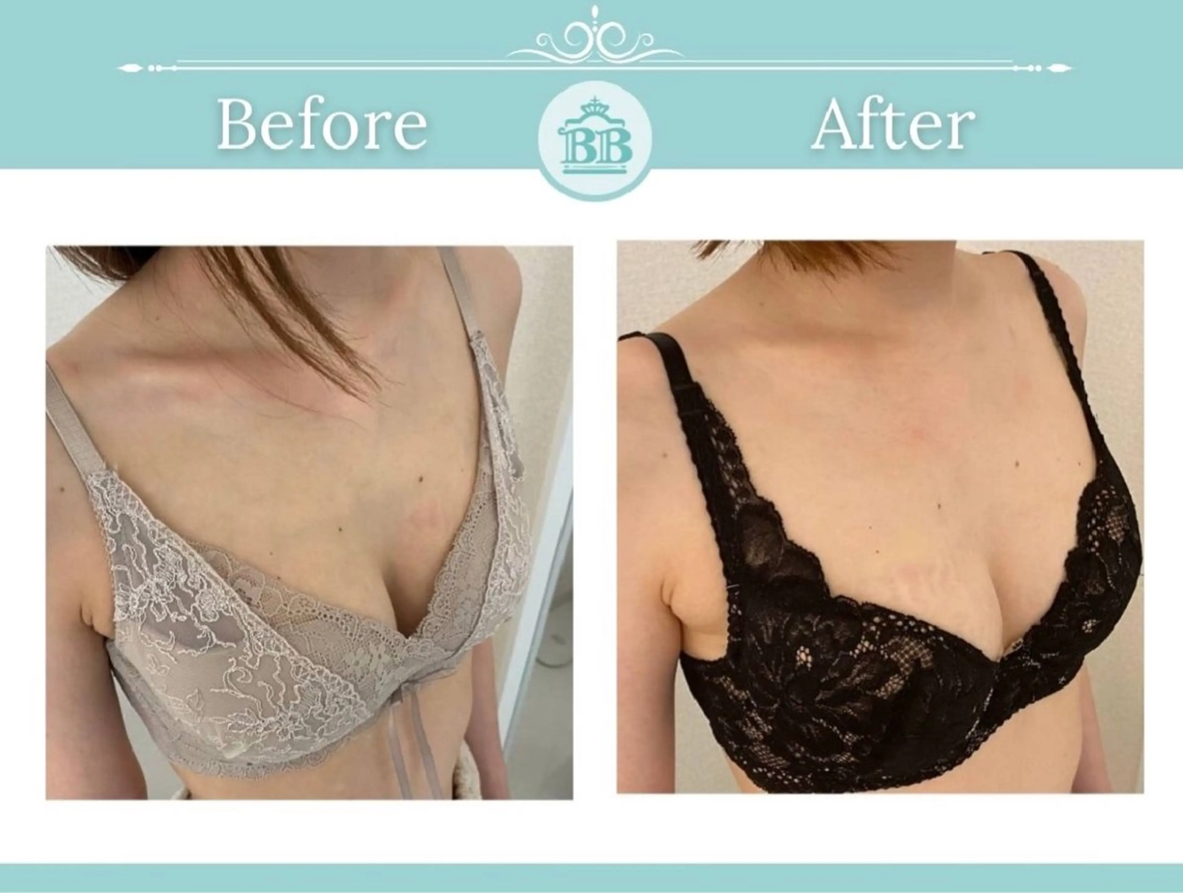 エステ 美人バスト本厚木店所属・美人バスト 本厚木店のエステ・リラクイメージ