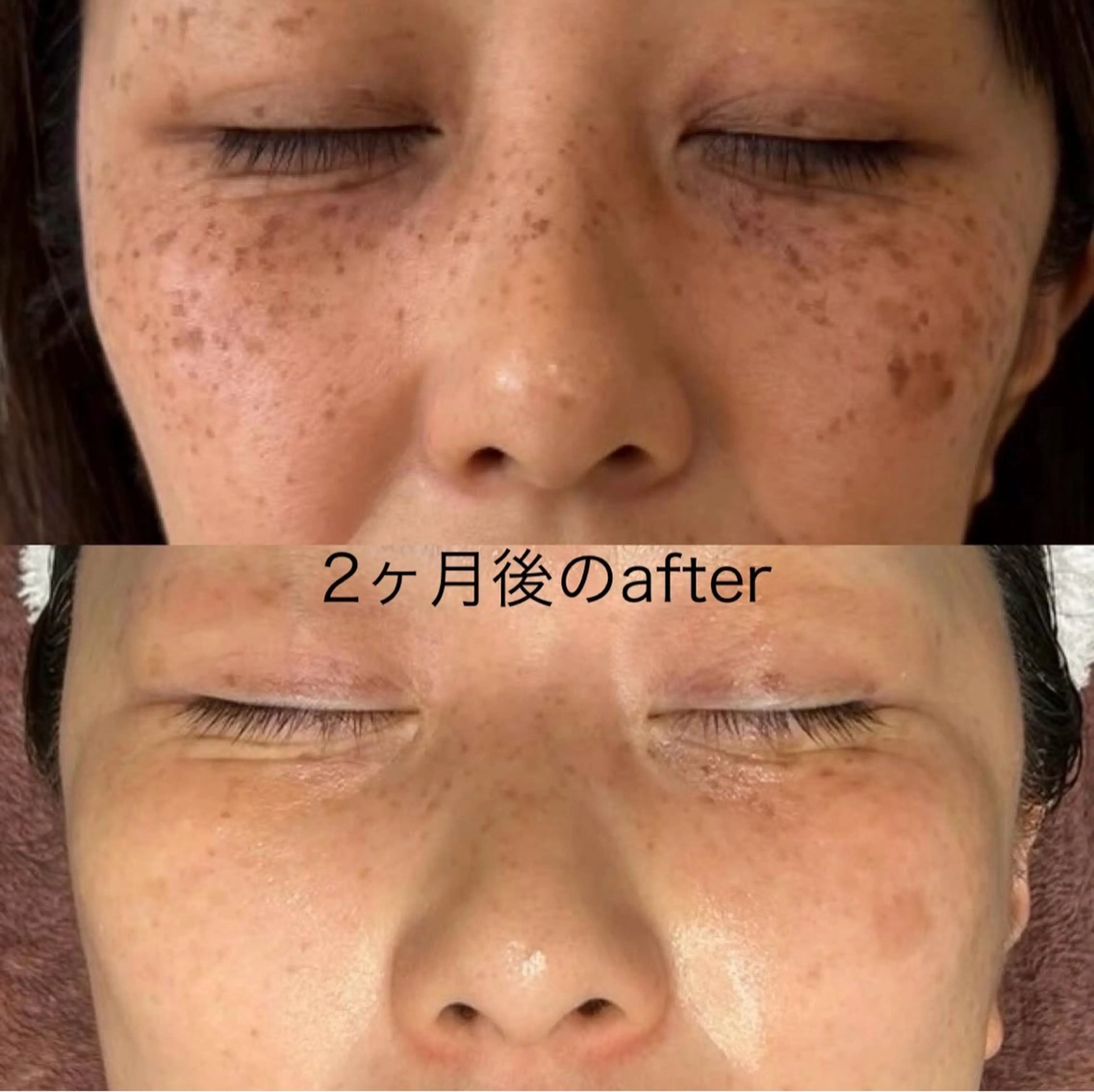 Rifuro毛穴ケア &よもぎ蒸しサロンの眉毛・アイブロウイメージ