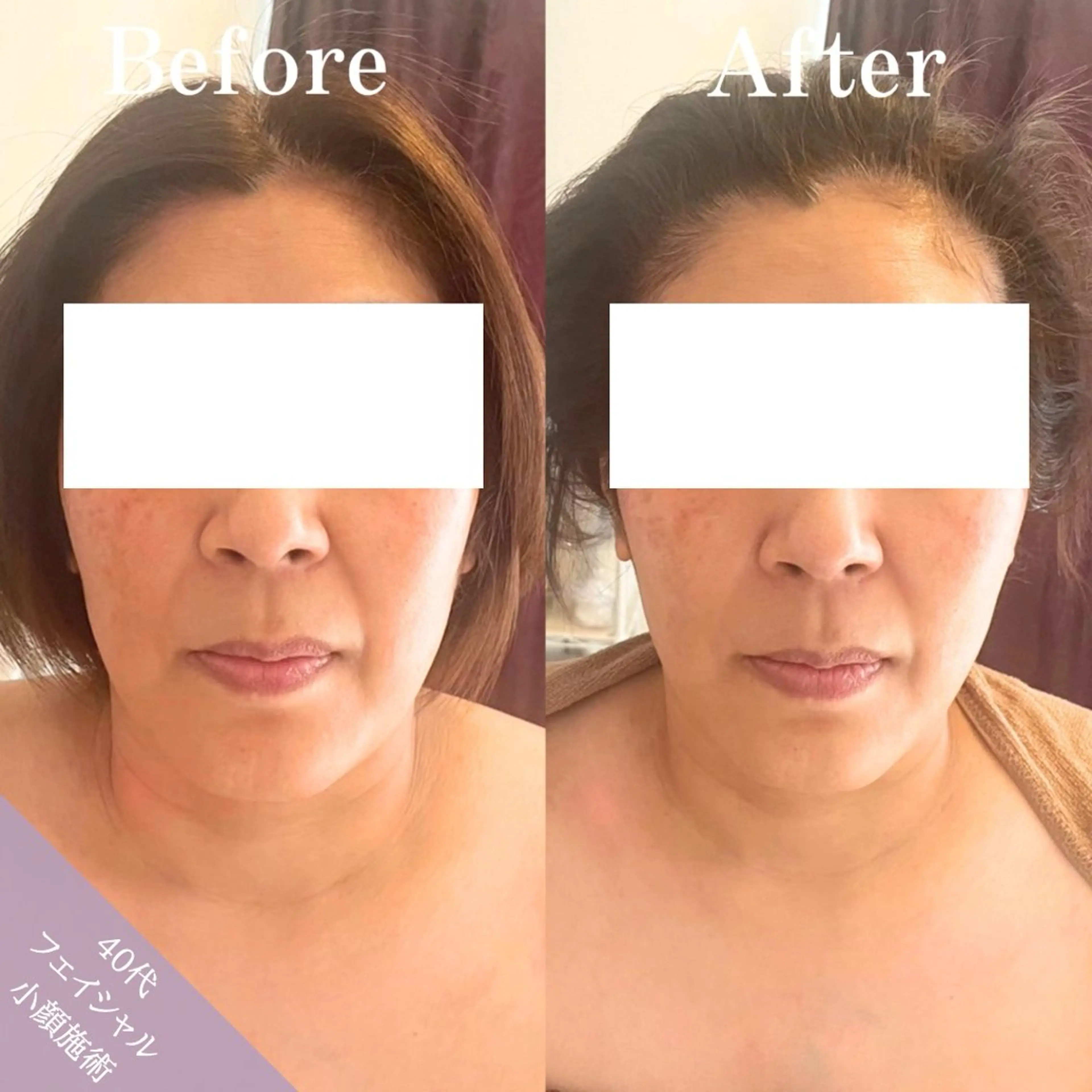 エステ Be-joux 【ビジュー】のエステ・リラクイメージ