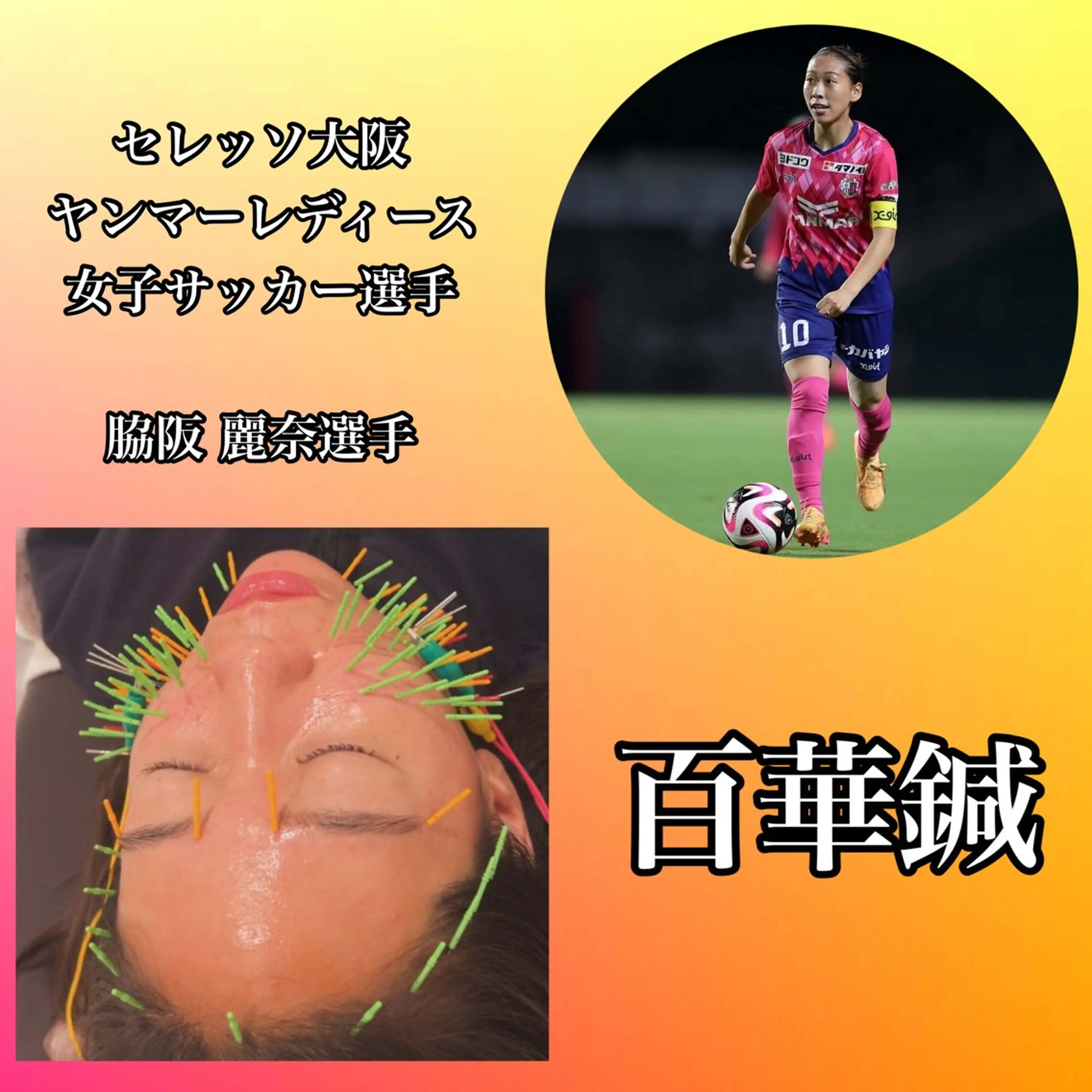 エステ リラク 肌質改善×美容鍼 ゆいのエステ・リラクイメージ