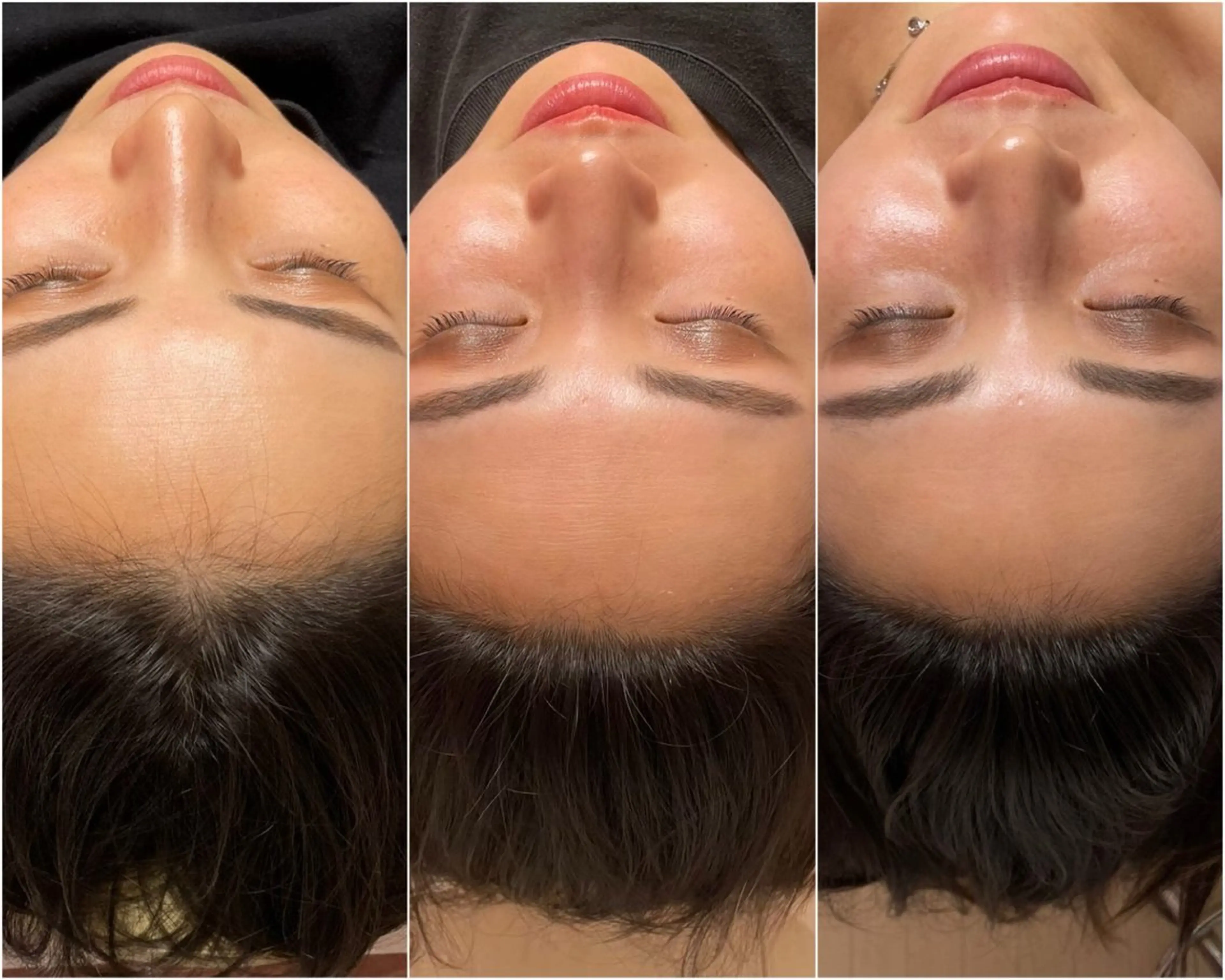 毛穴レス ハーブ＆ ワックス脱毛×光脱毛のエステ・リラクイメージ