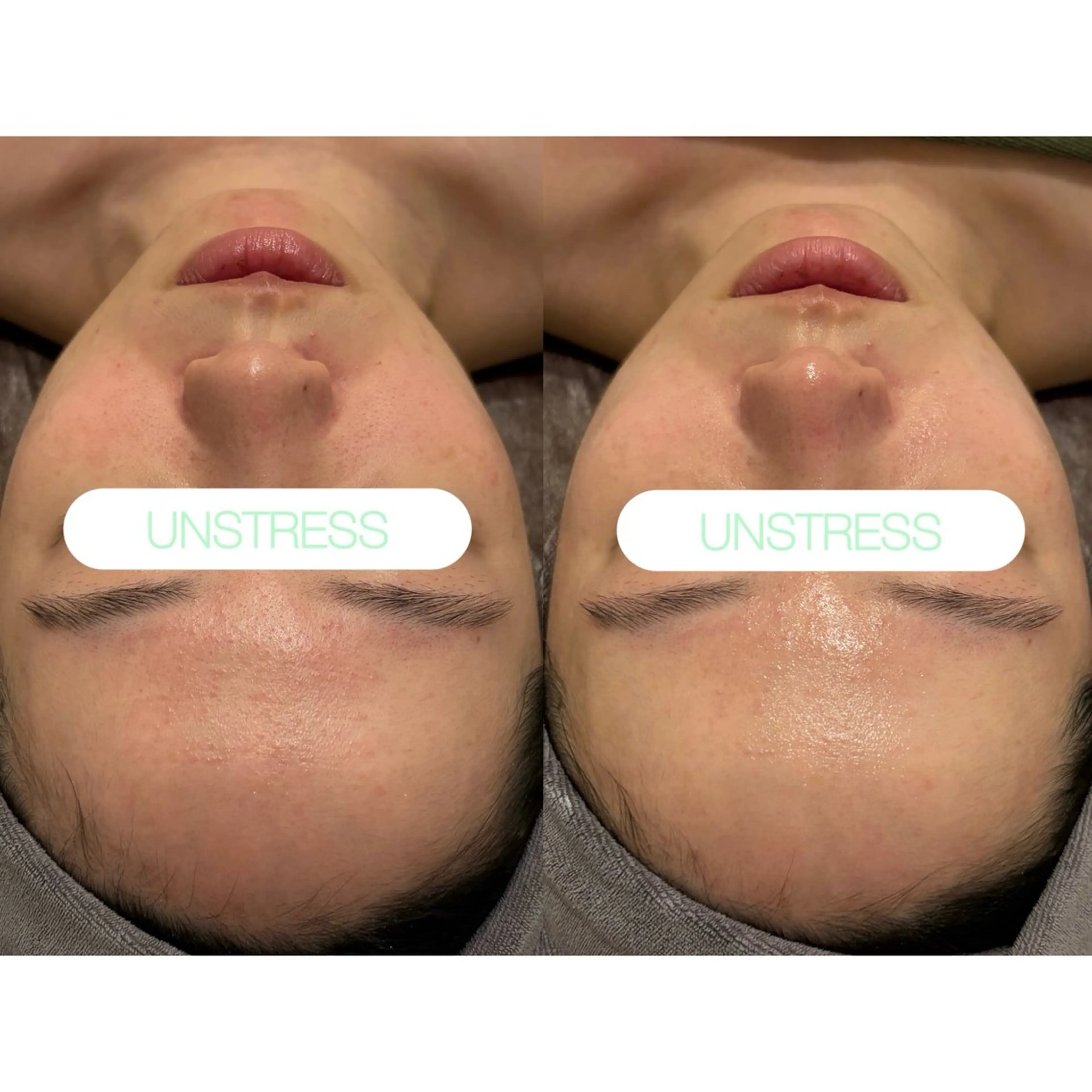 エステ 小顔コルギ ☆表参道/外苑前のエステ・リラクイメージ