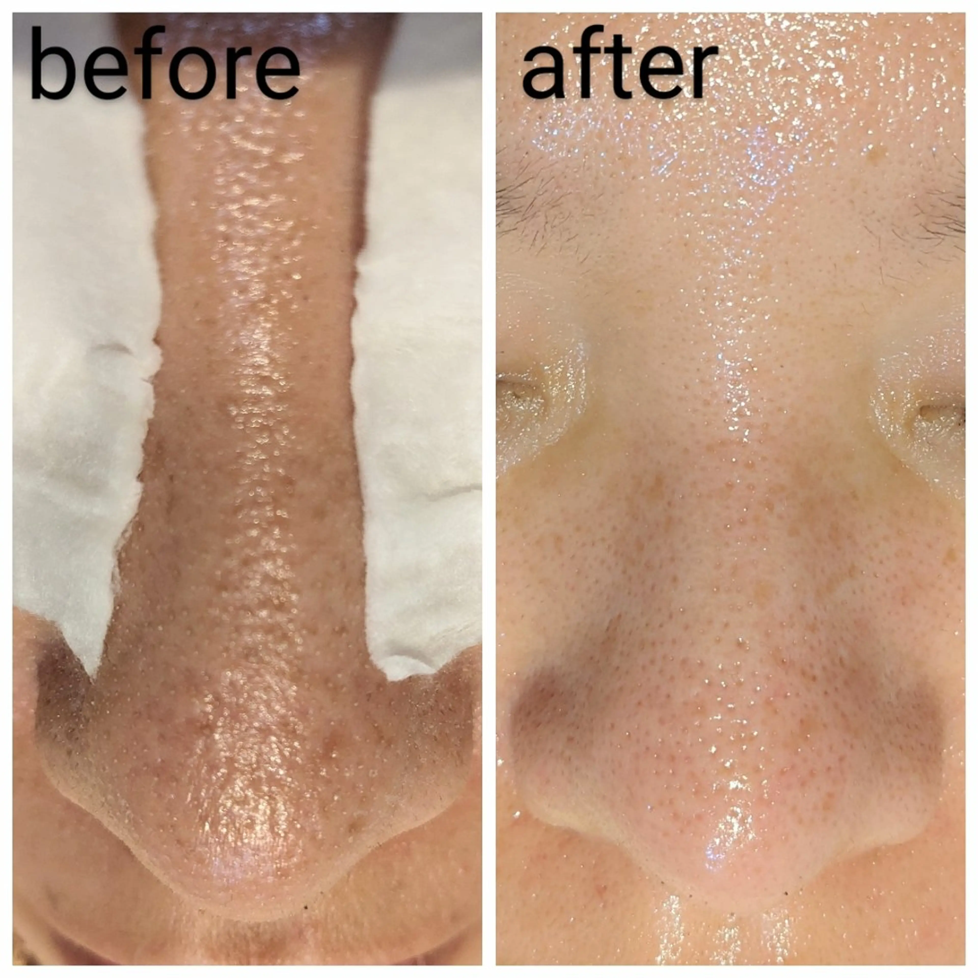 フェイシャル/毛穴 /シミ/たるみ東灘区のエステ・リラクイメージ