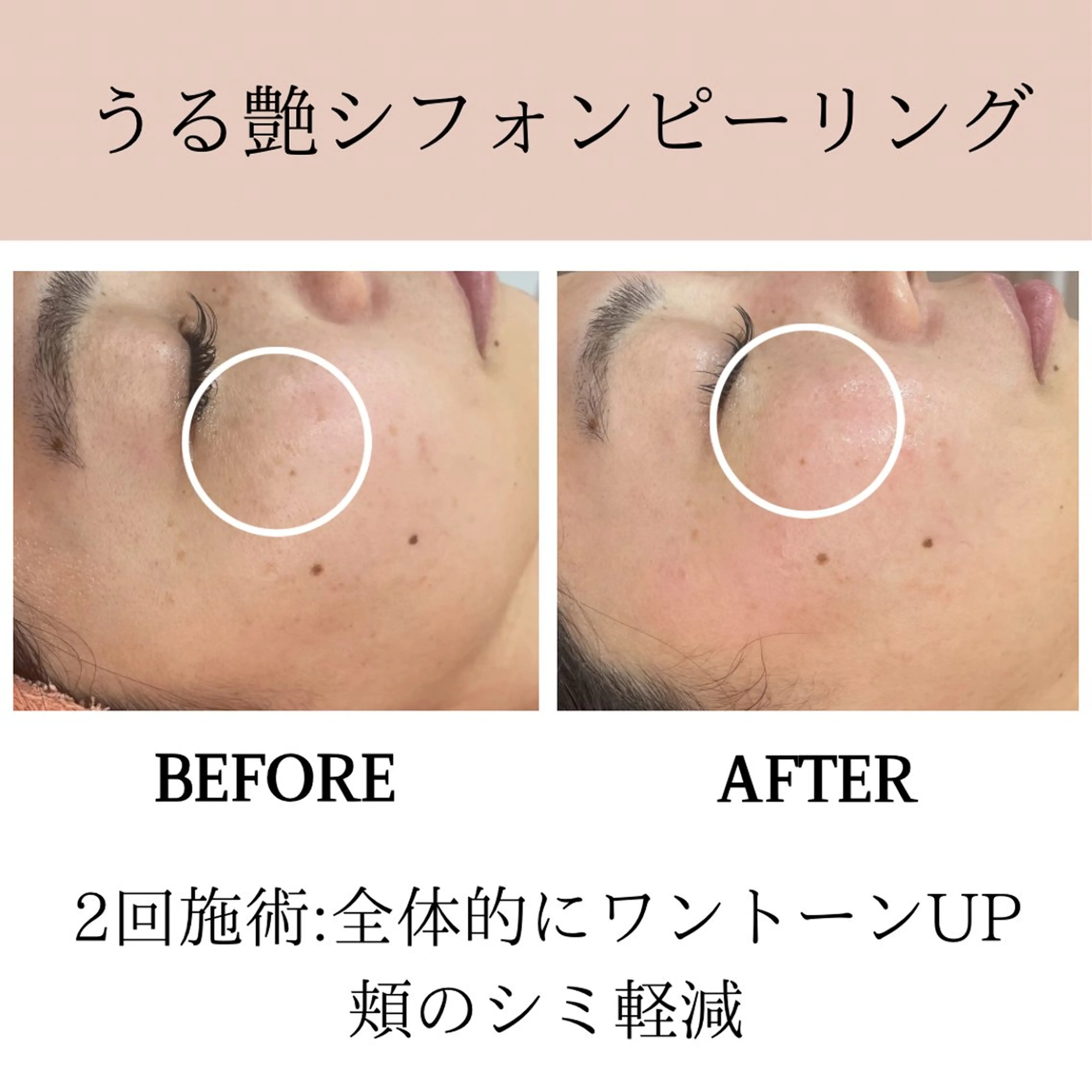 エステ 肌質改善専門サロン Bellmi/心斎橋のエステ・リラクイメージ