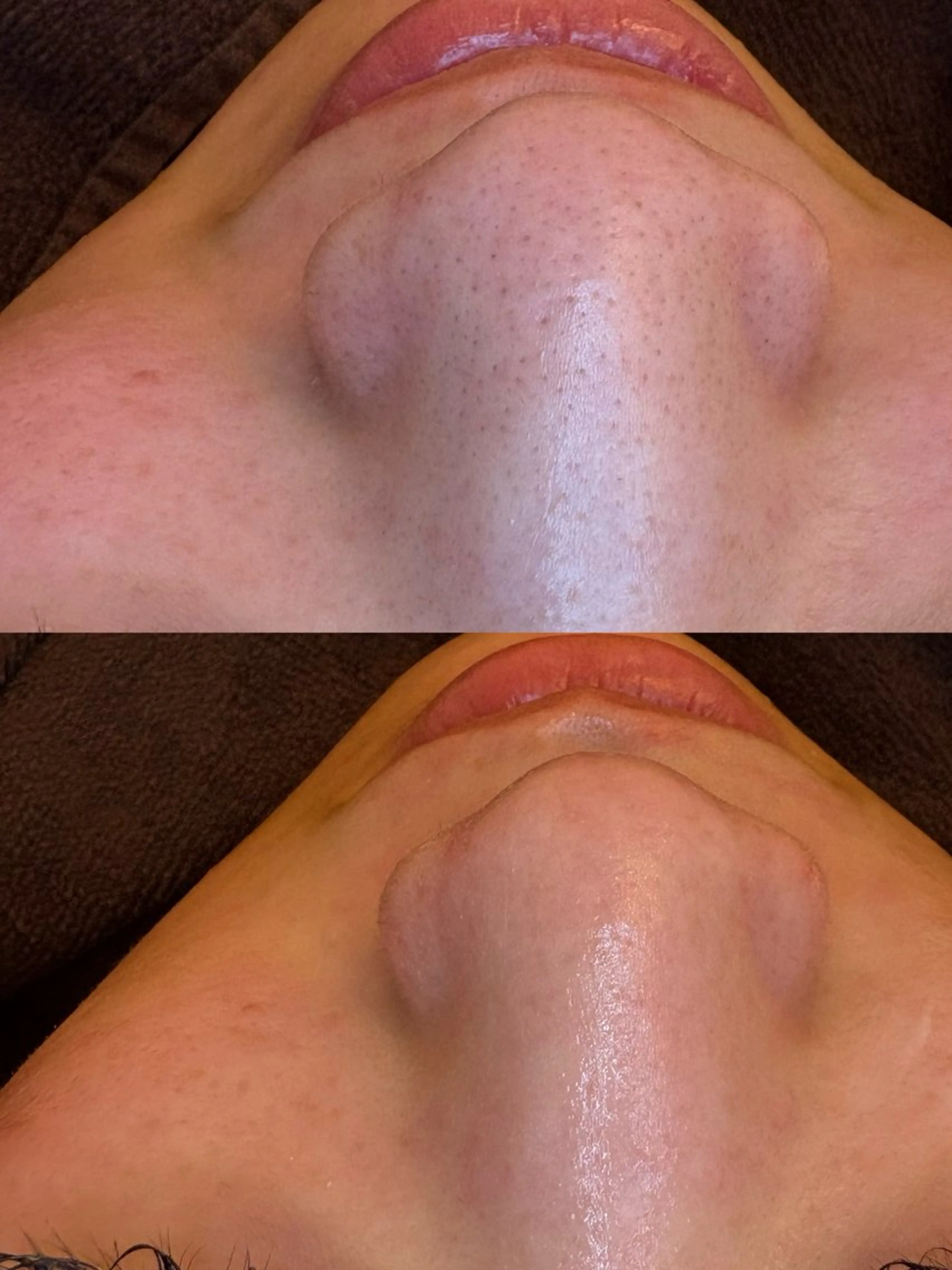 🤍アベシュリ /フェイシャル🤍のエステ・リラクイメージ