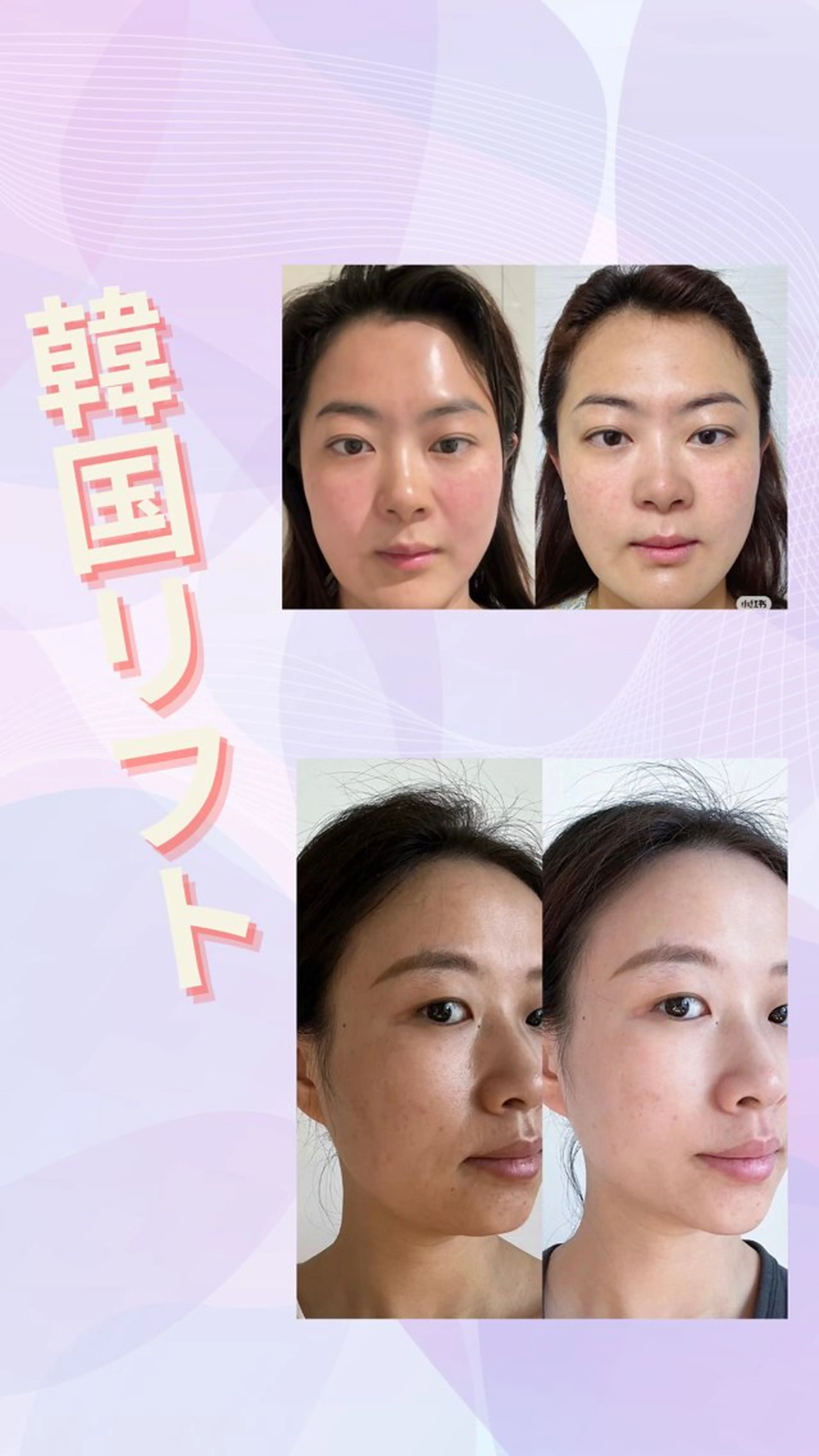 マツエク・マツパ エステ リラク 愛維美水光美肌専門店 メンズレディースokのエステ・リラクイメージ