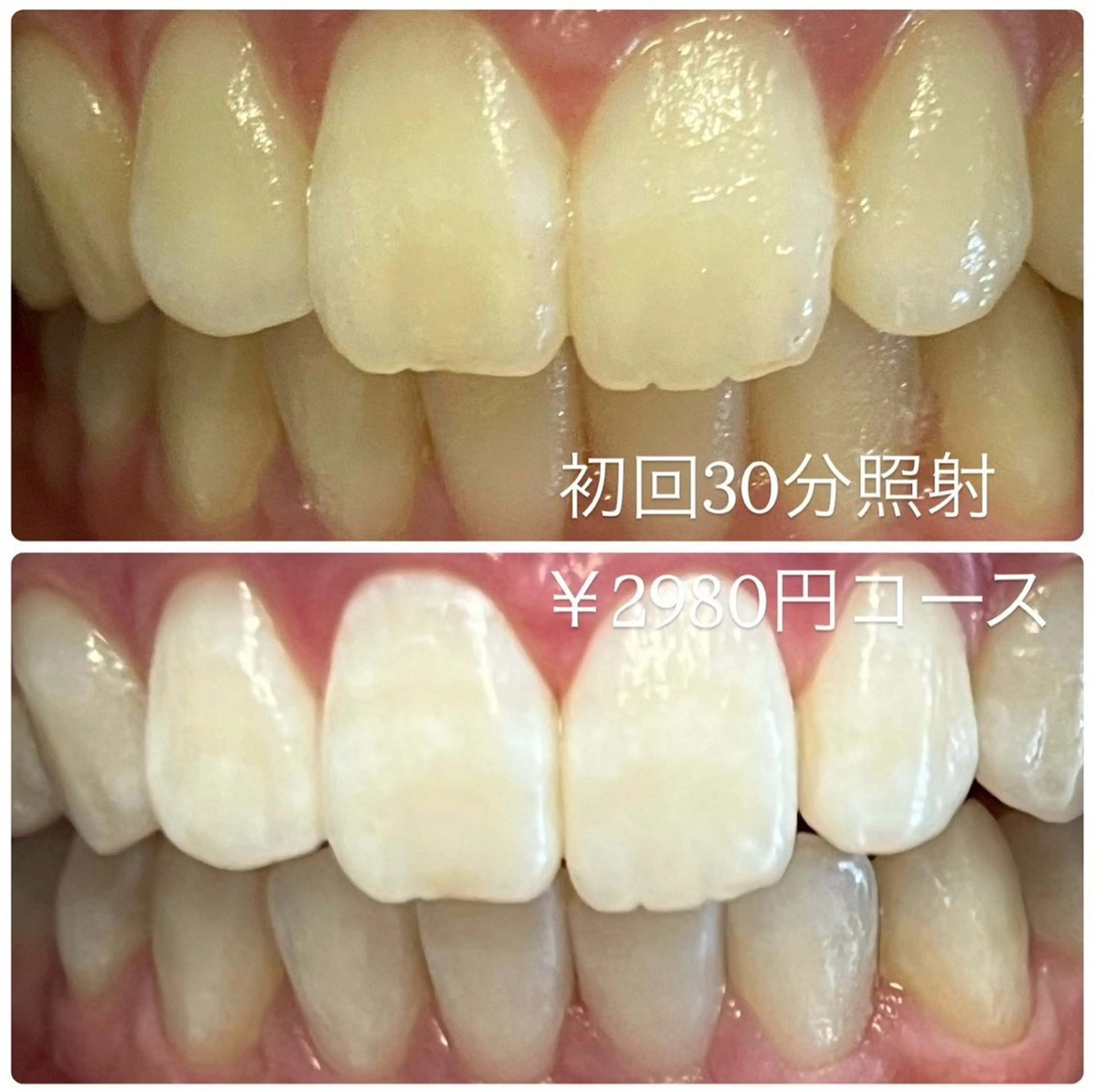 その他 PLATINUM Beauty 横浜店所属・ホワイトニングルーム 横浜店のその他イメージ