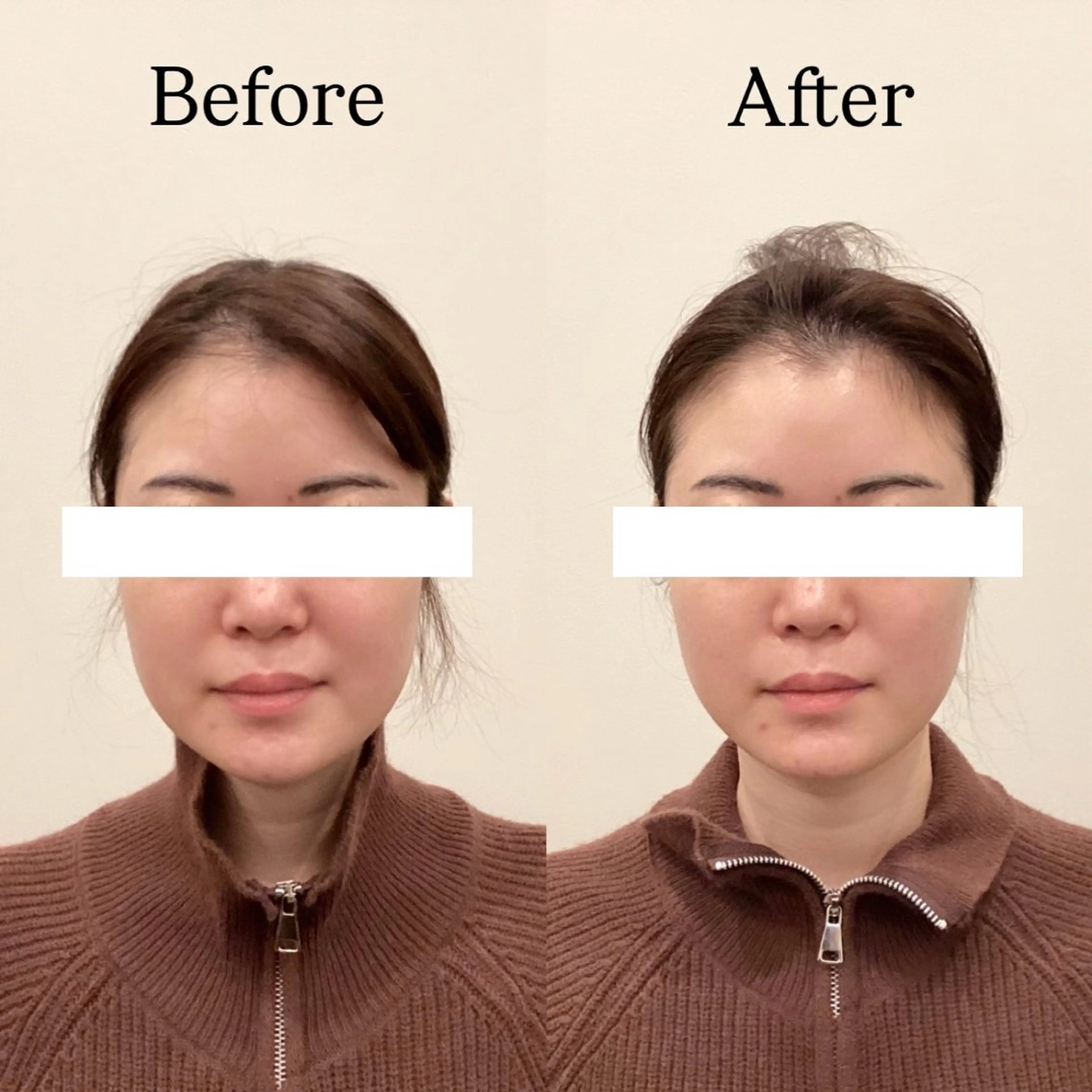 chika🦋 ハリラウンジ恵比寿のエステ・リラクイメージ