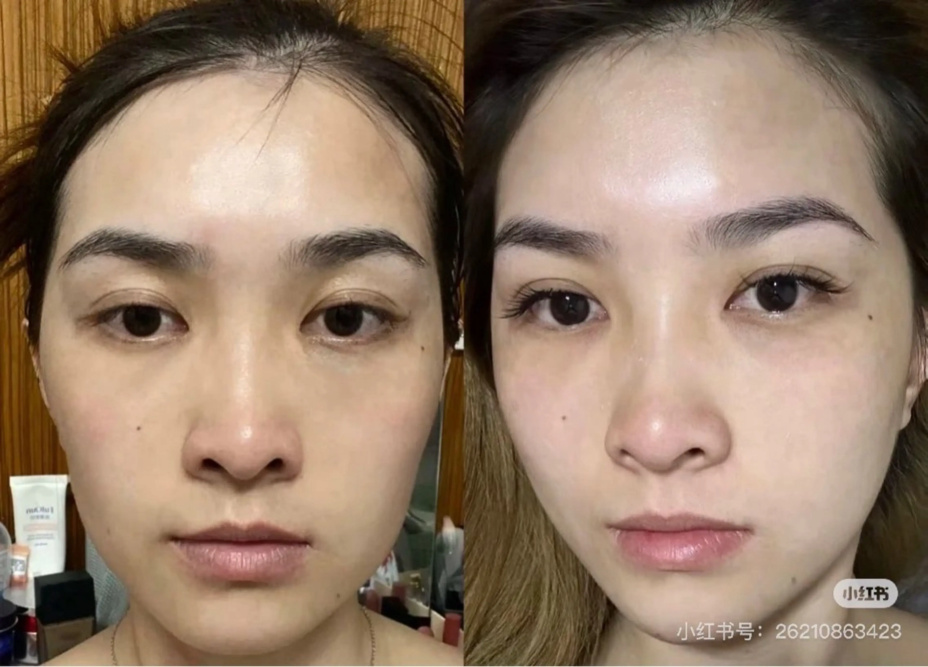 マツエク・マツパ エステ リラク 愛維美水光美肌専門店 メンズレディースokのエステ・リラクイメージ