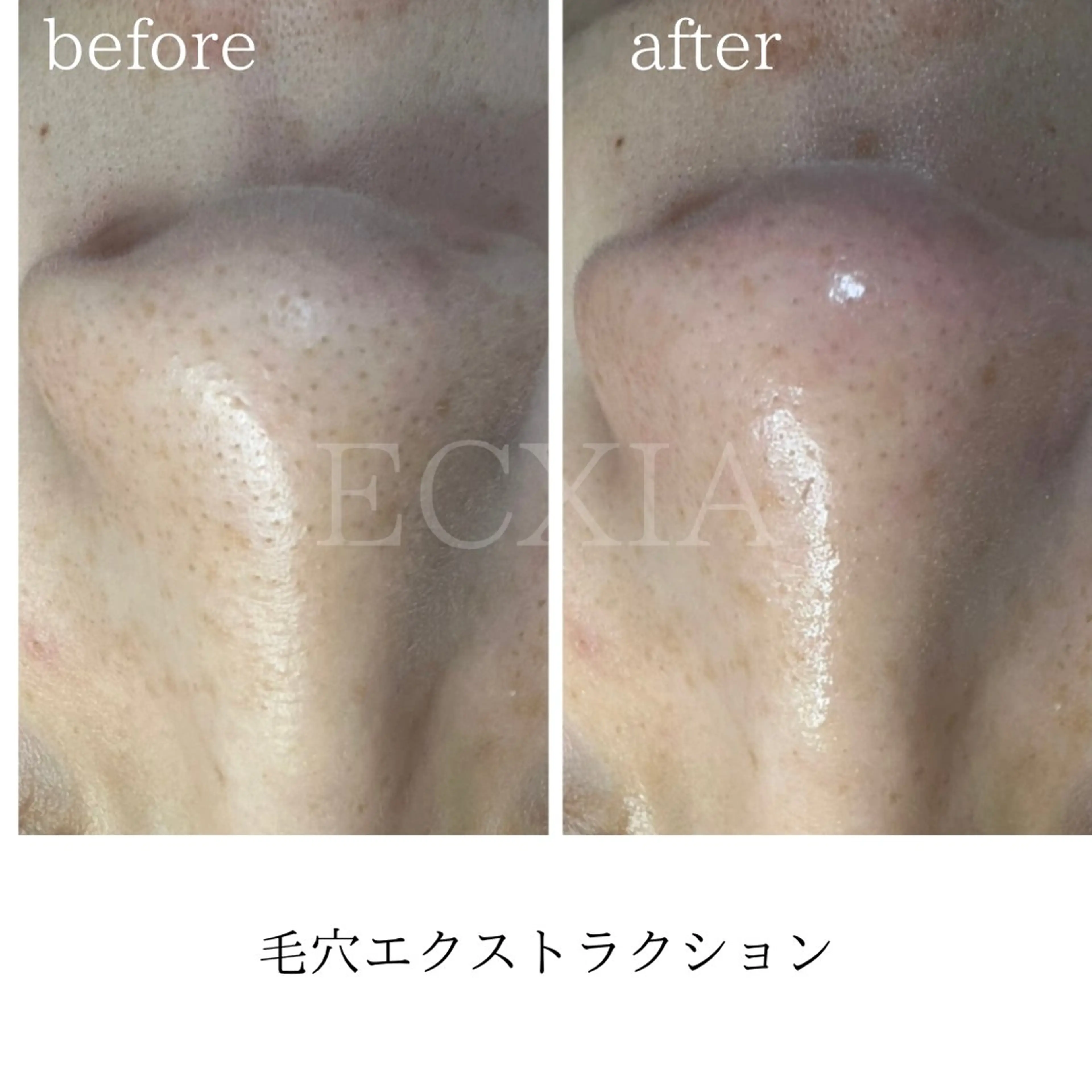 エステ ECXIA 【エクシア】のエステ・リラクイメージ