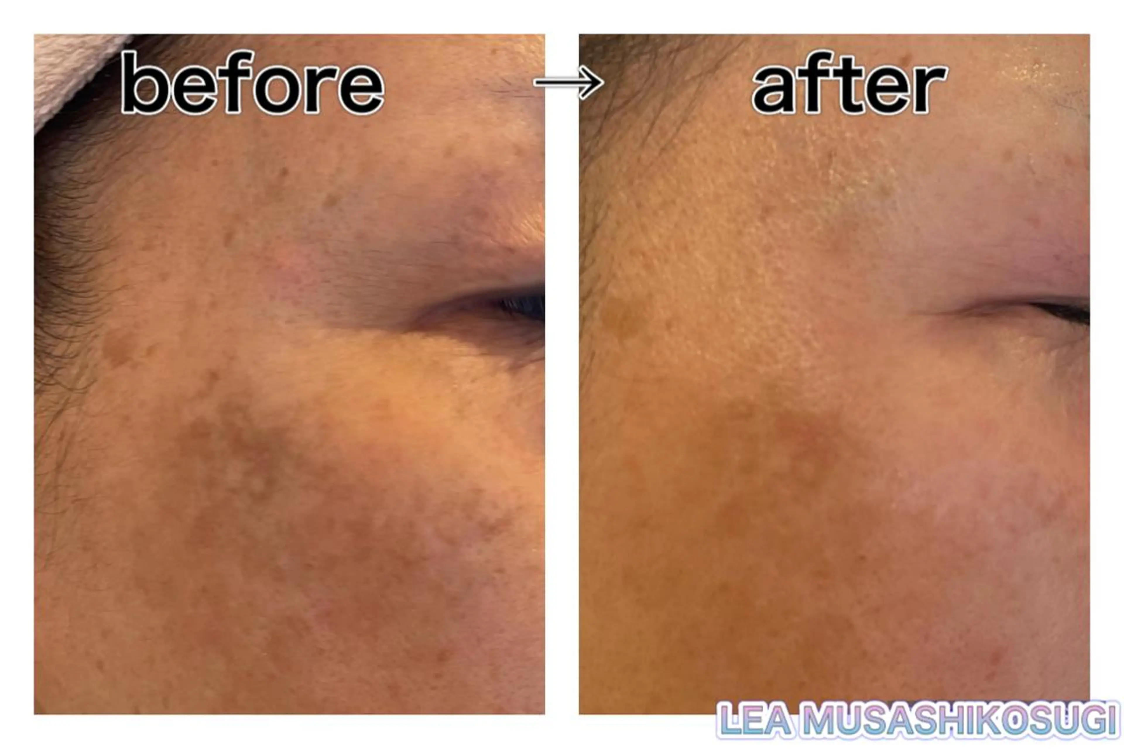 美肌育成サロン LEA武蔵小杉のエステ・リラクイメージ