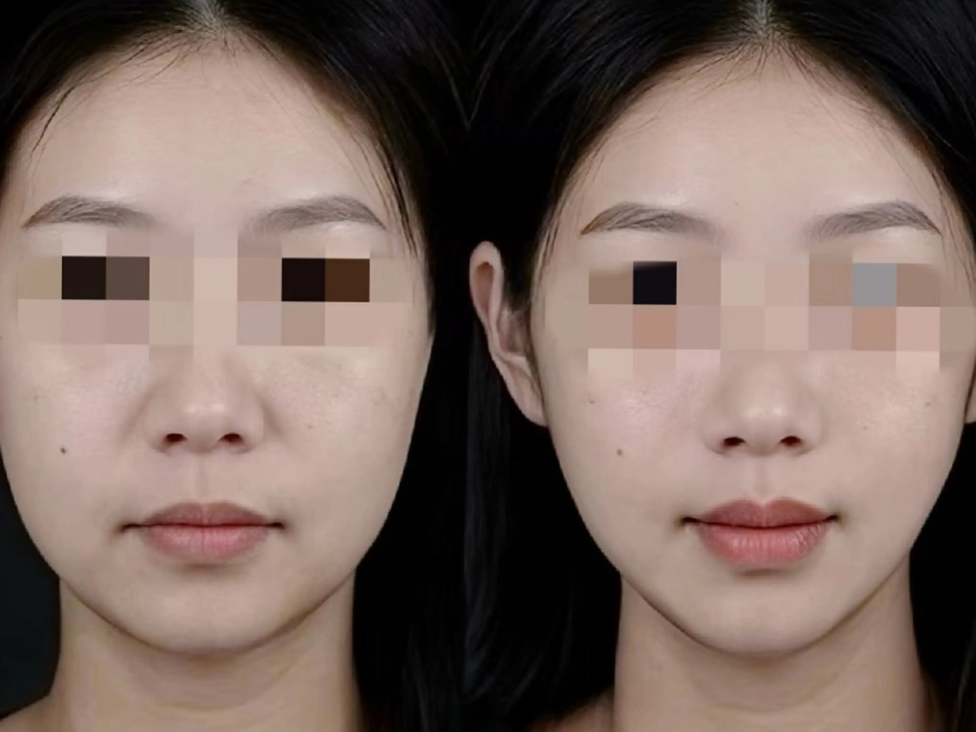 エステ aliaハイフ&水光ジェットサロン所属・aliaハーブ水光店 エステティシャン募集のエステ・リラクイメージ