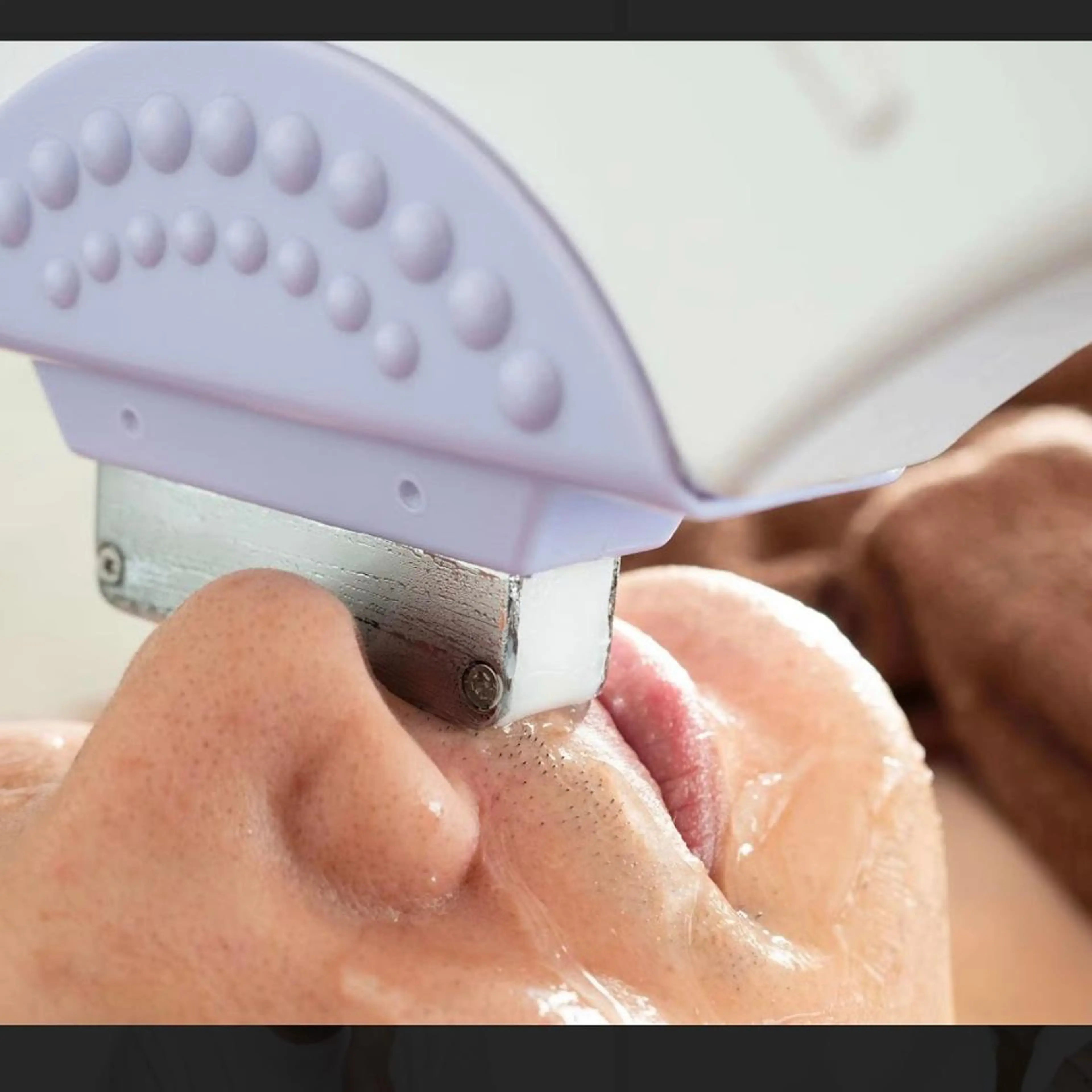 メンズ ヒゲ 光脱毛 保湿ケア付き☆の写真