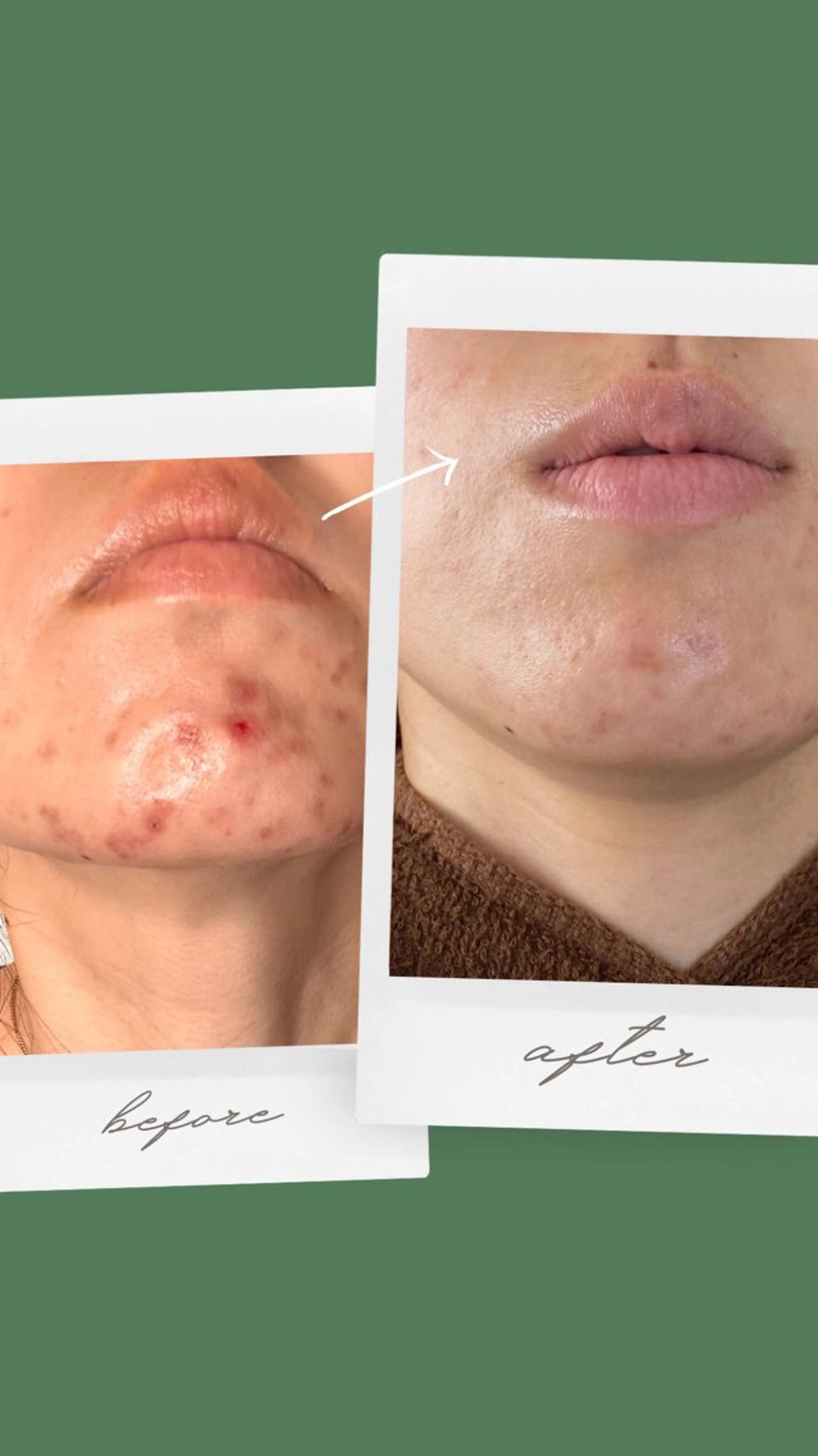 ビューティーホリック 東金店のエステ・リラクイメージ