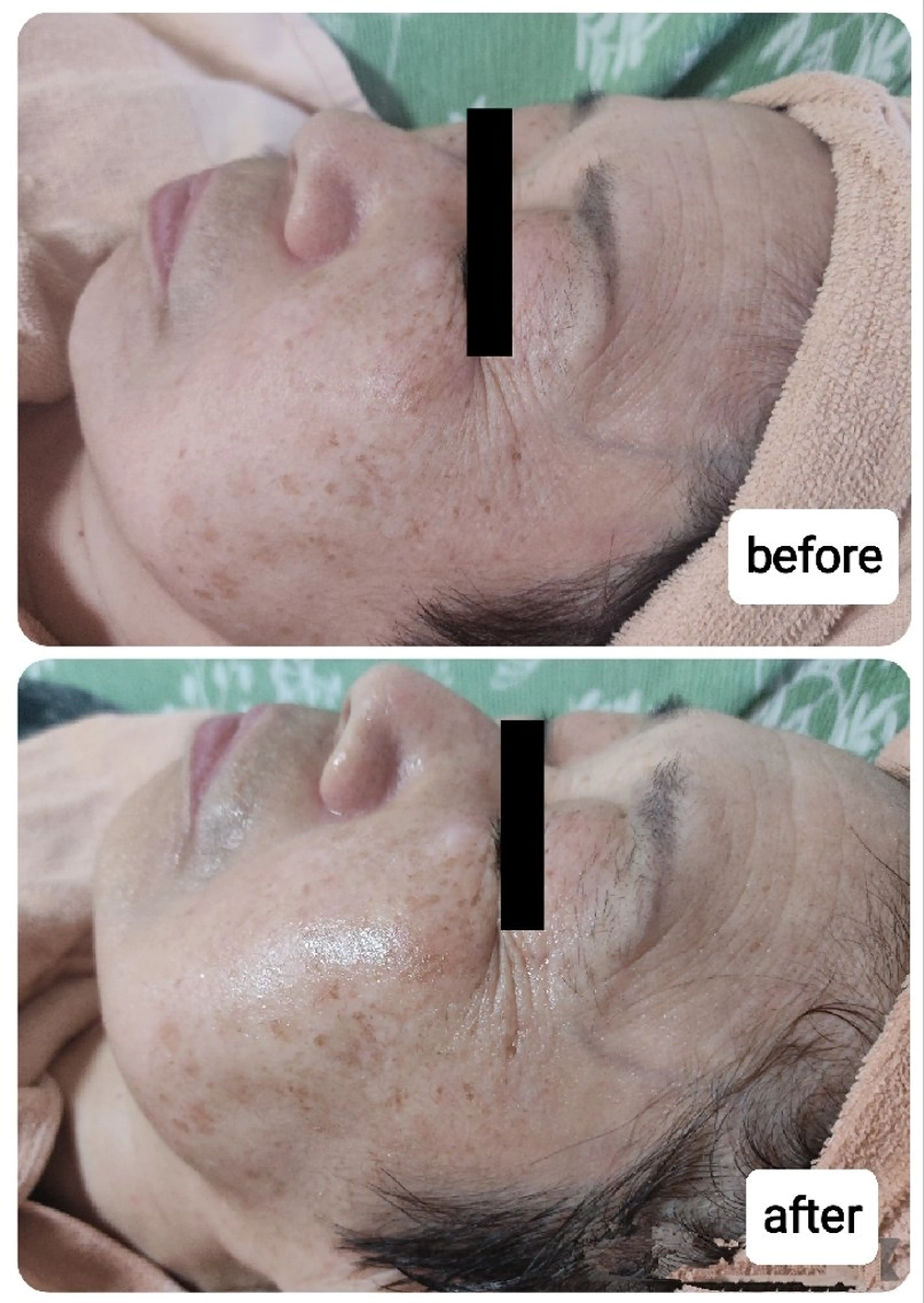 その他 山野愛子どろんこ美容 Laughのエステ・リラクイメージ