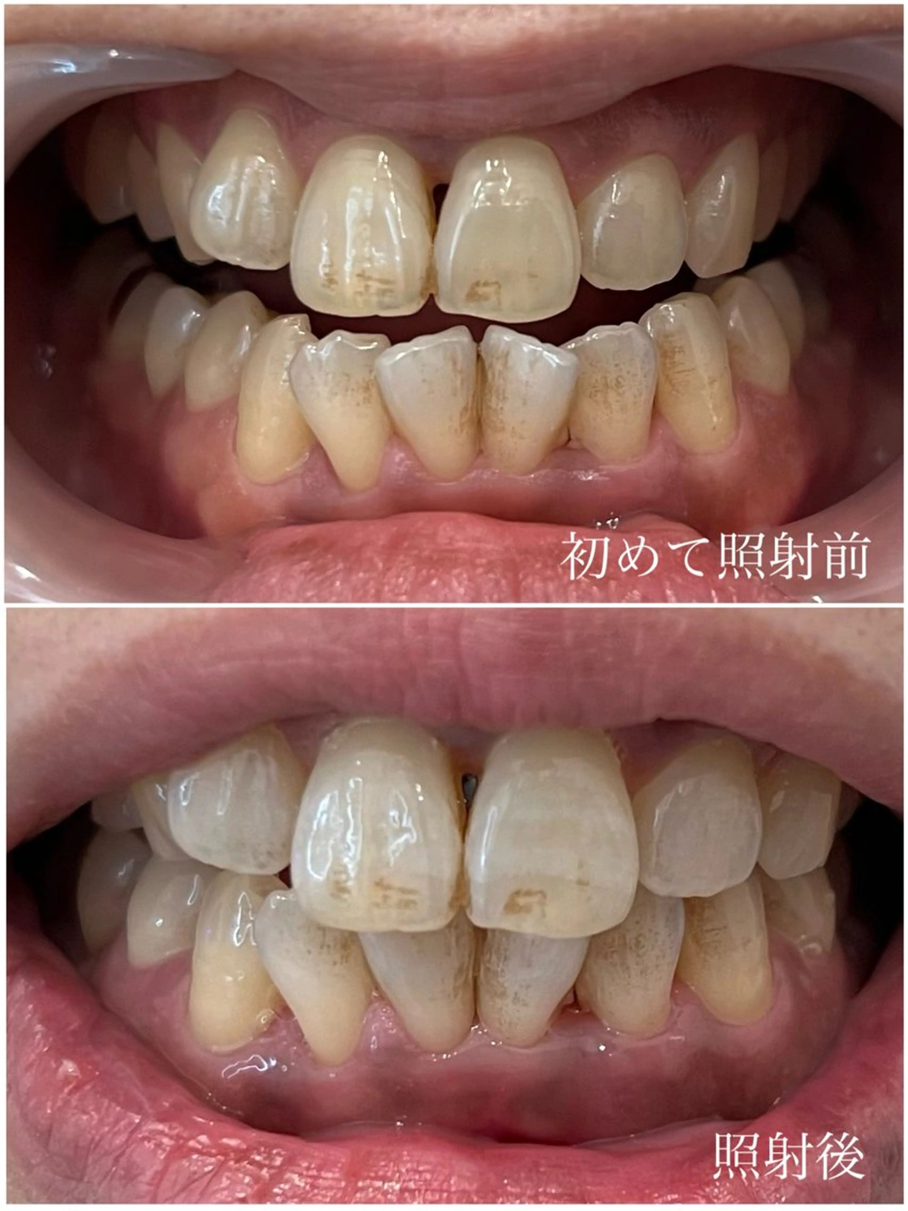 キッズ その他 𝐑𝐞𝐯𝐢𝐨 ___堺市西区のマツエク・マツパデザイン