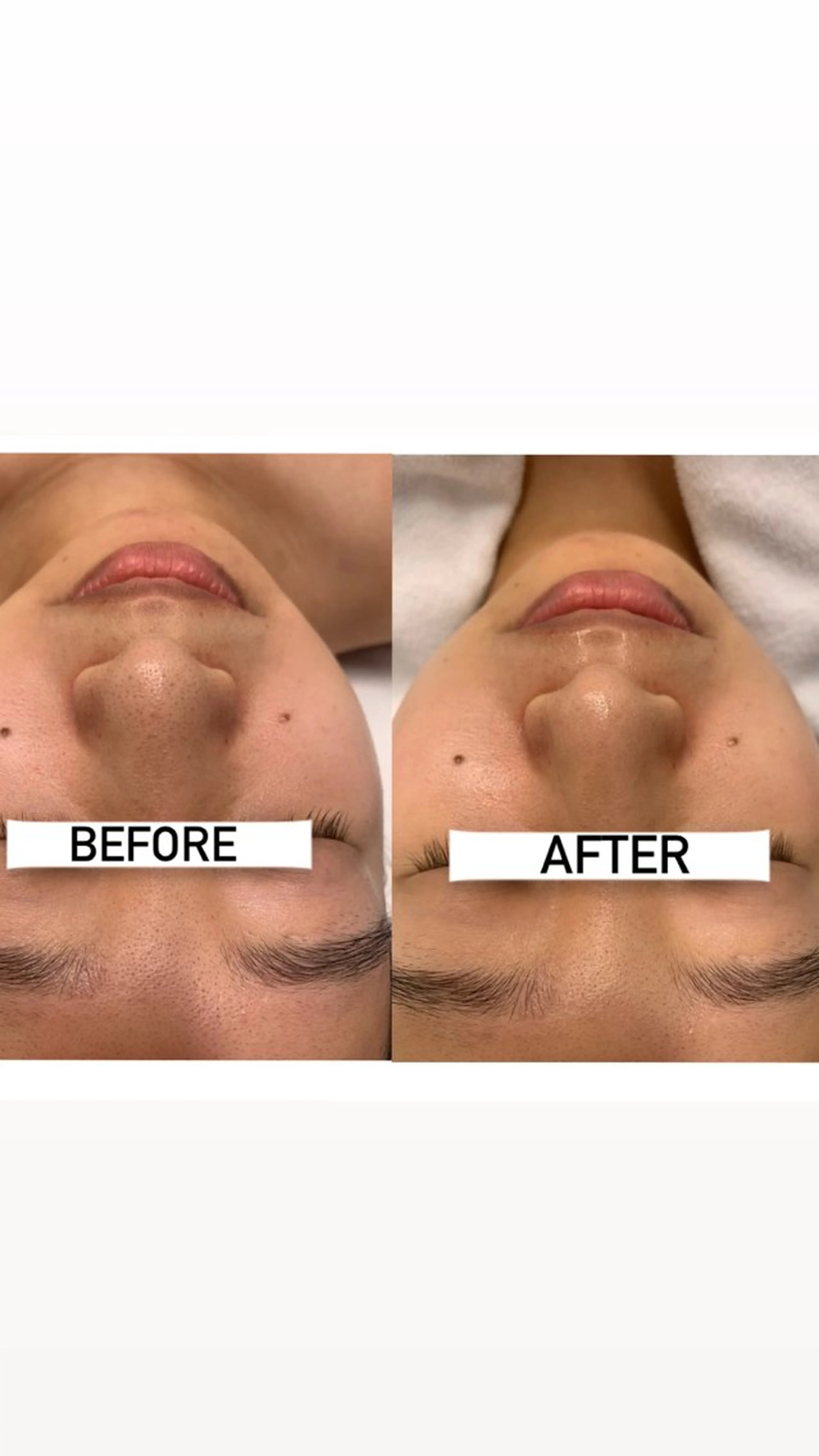 エステ リラク ナリスビューティサロンあべの所属・肌質改善/ツヤ肌作り /松本杏奈のエステ・リラクイメージ