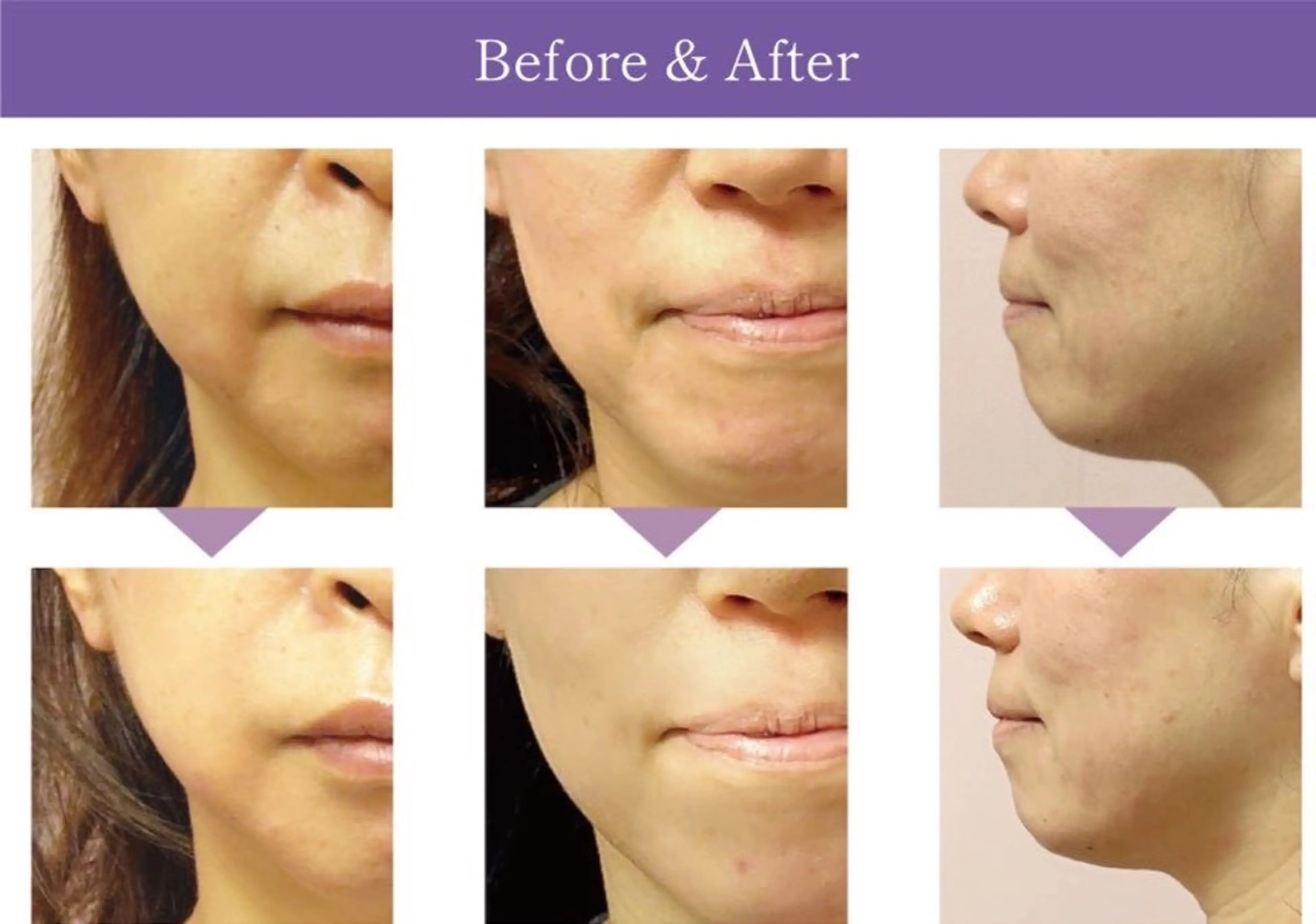 エステ 飯田 千晶のエステ・リラクイメージ