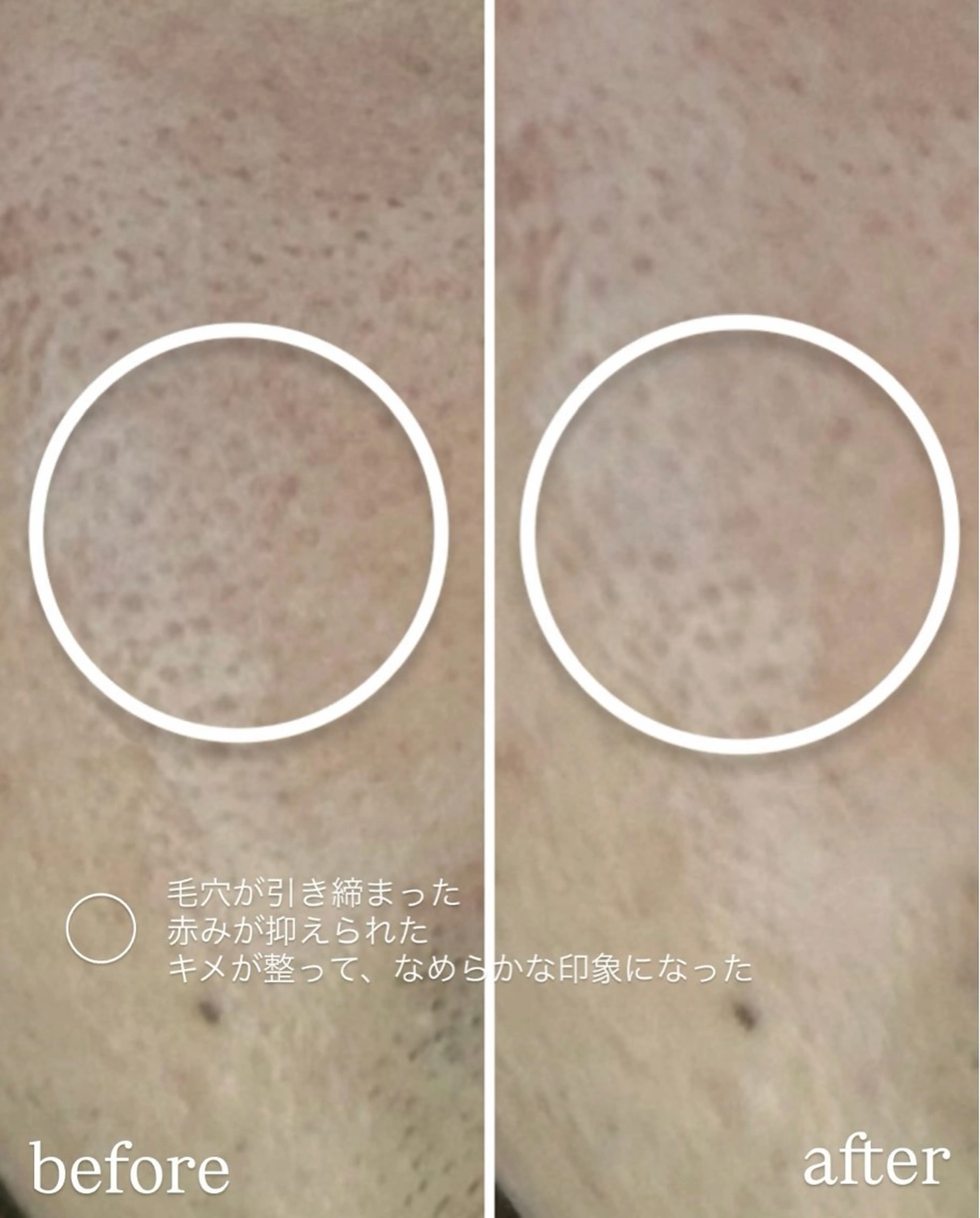 エステ デアイム もえかのエステ・リラクイメージ