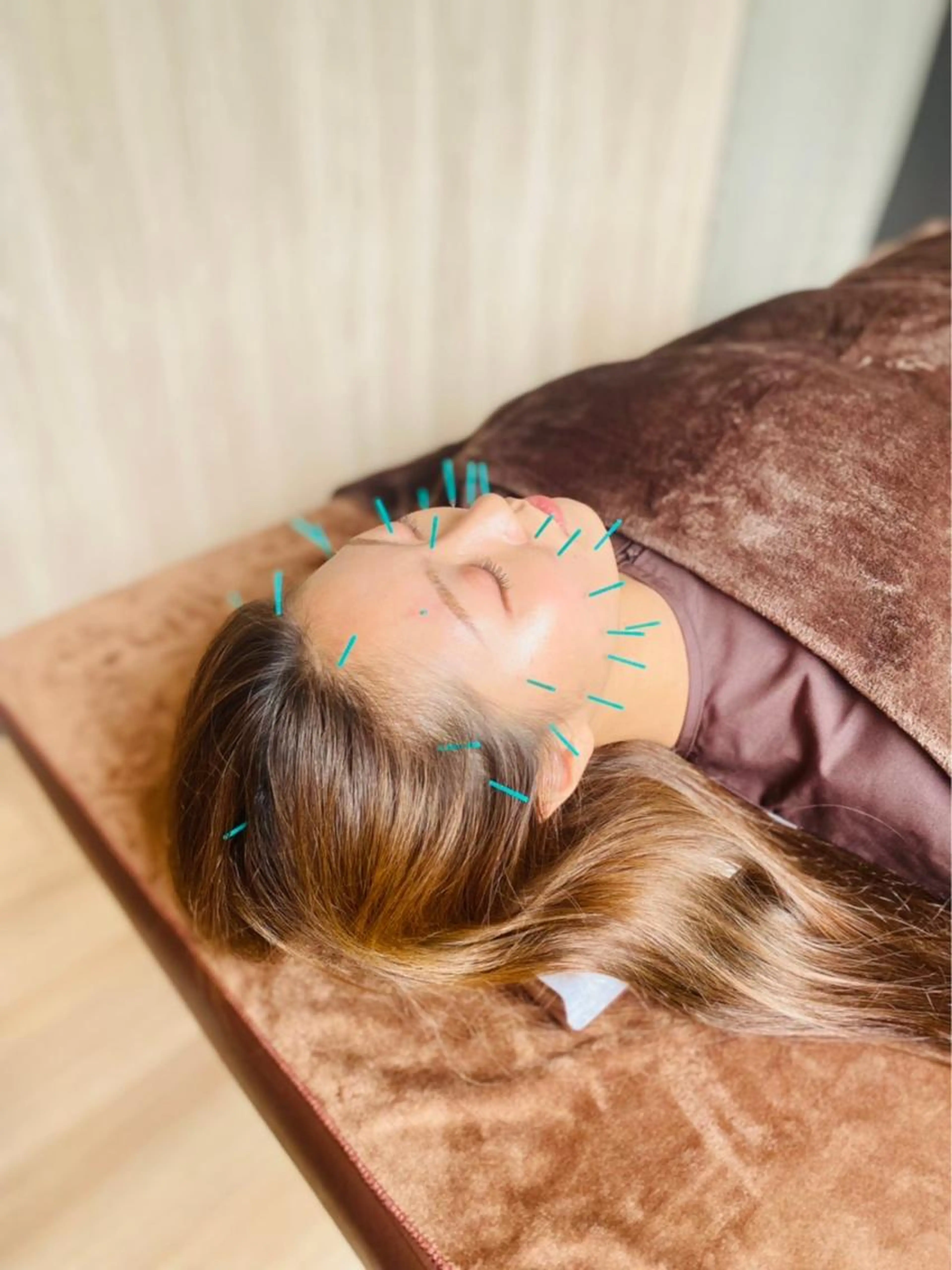 カウンセリングにてご希望のメニューをオーダー施術🌟美容鍼、電気美容鍼、小顔リンパマッサージの写真