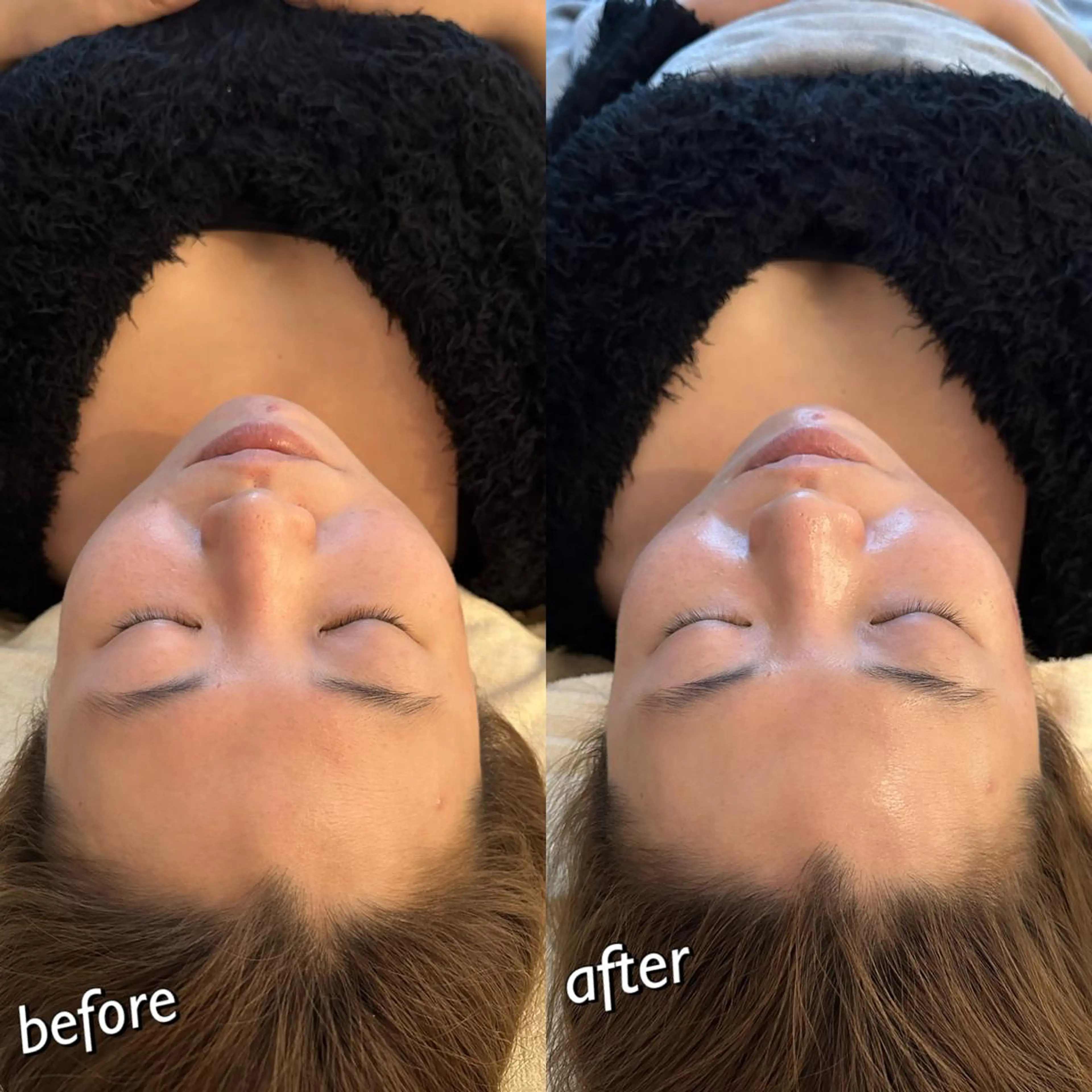 うなじ脱毛/美肌脱毛 LABELのエステ・リラクイメージ