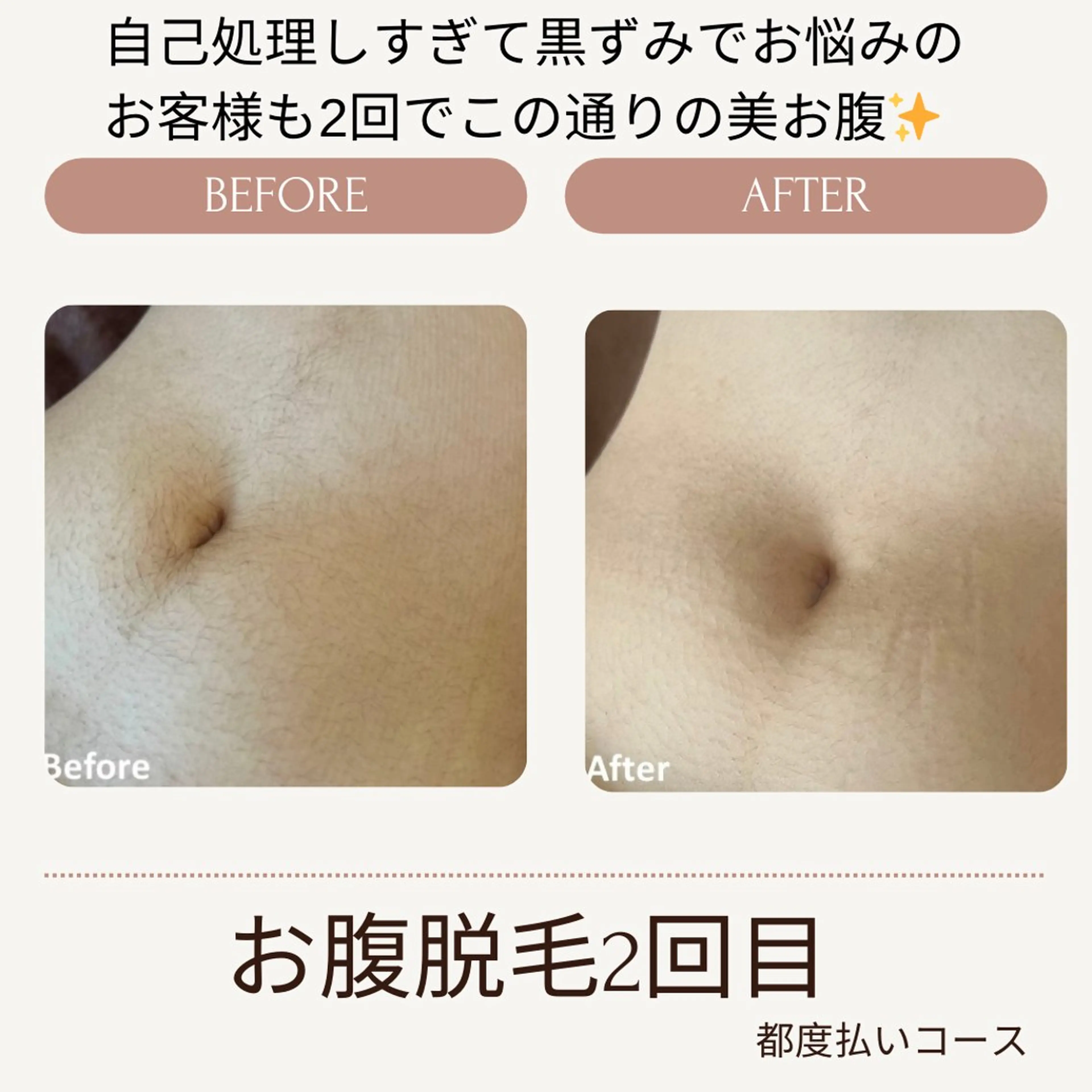 脱毛 VANILLA SKY所属・VANILLA SKYのエステ・リラクイメージ