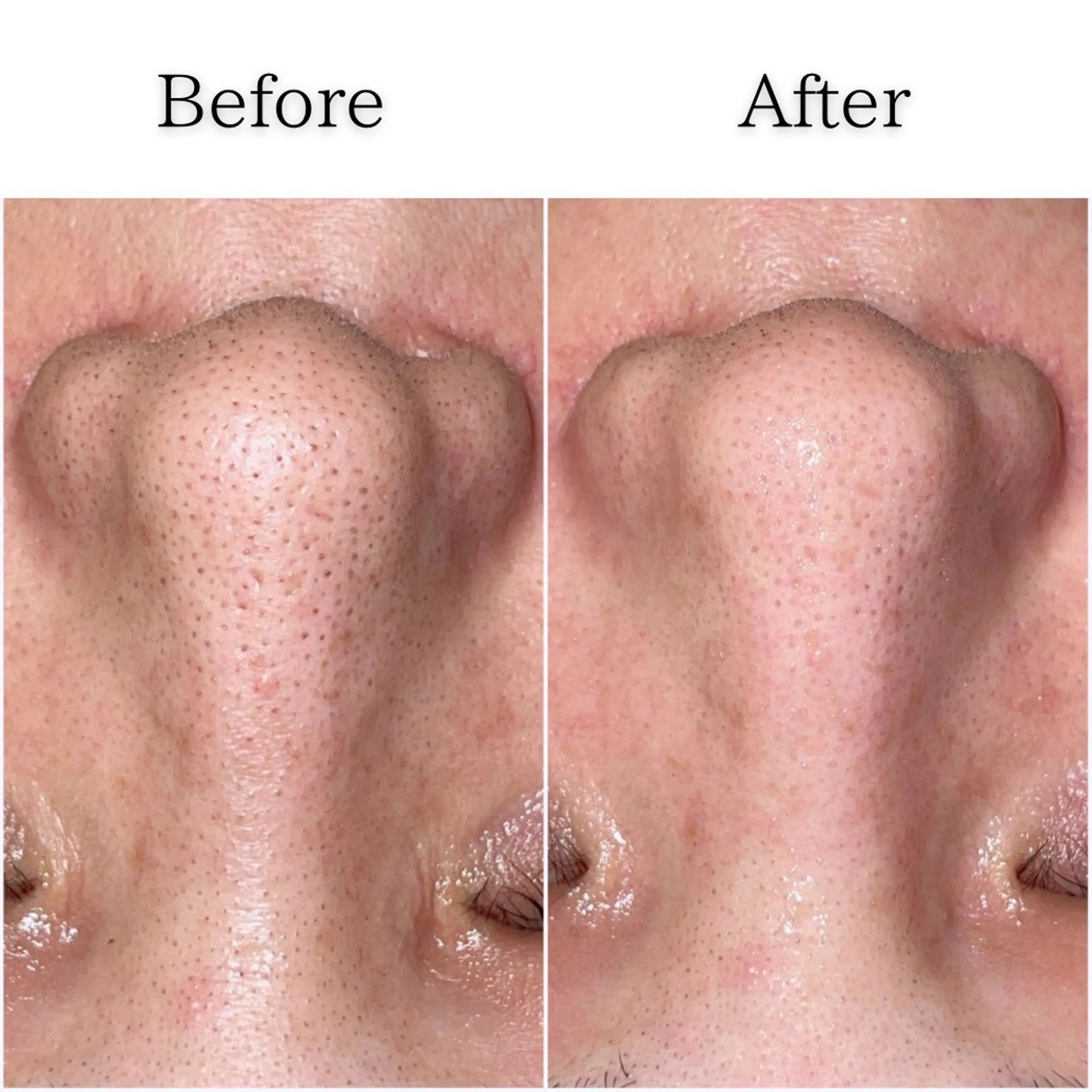 エステ SELF  BEAUTY gracia浦添店所属・gracia 浦添店のその他イメージ