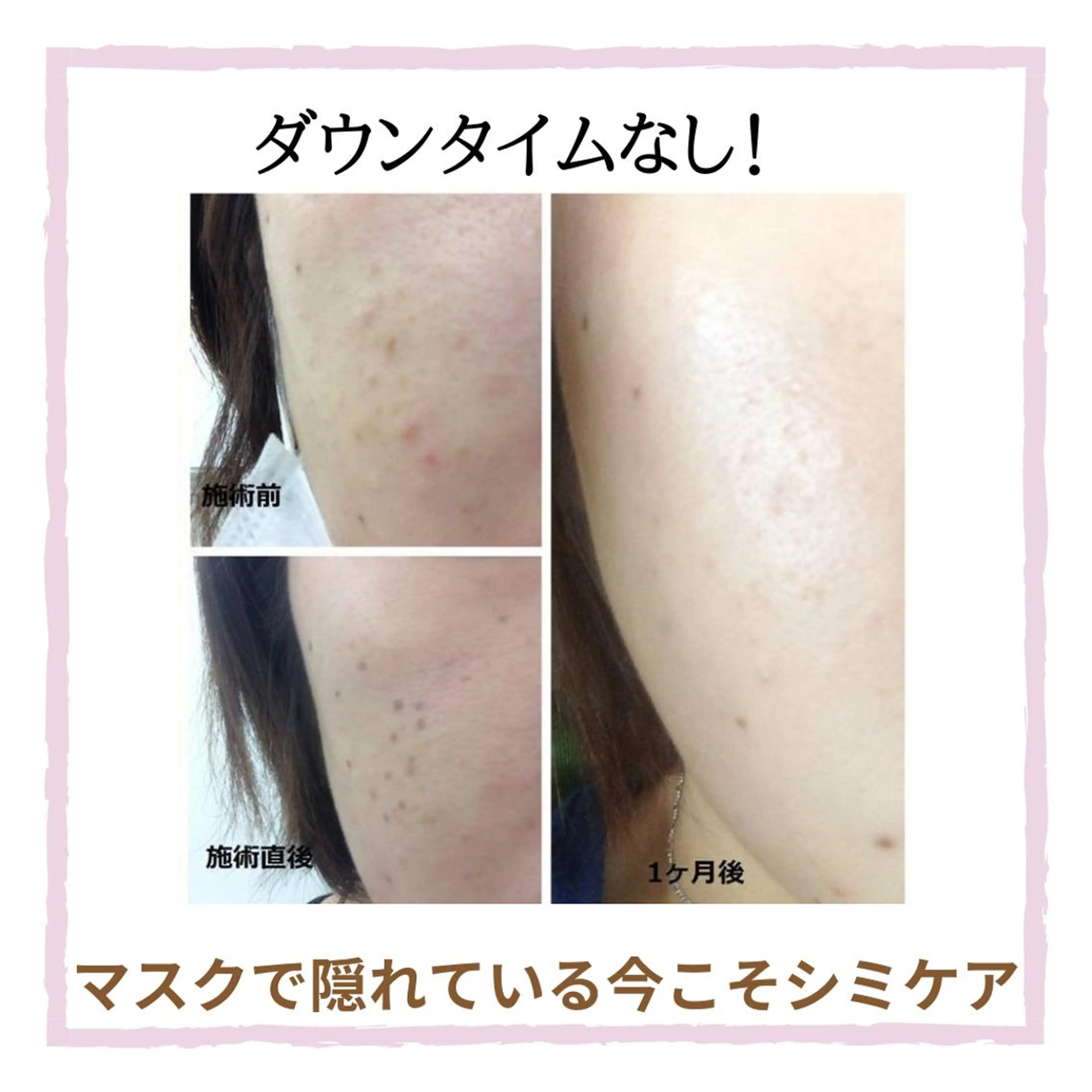 毛穴・シミ専門サロン ルパークのエステ・リラクイメージ