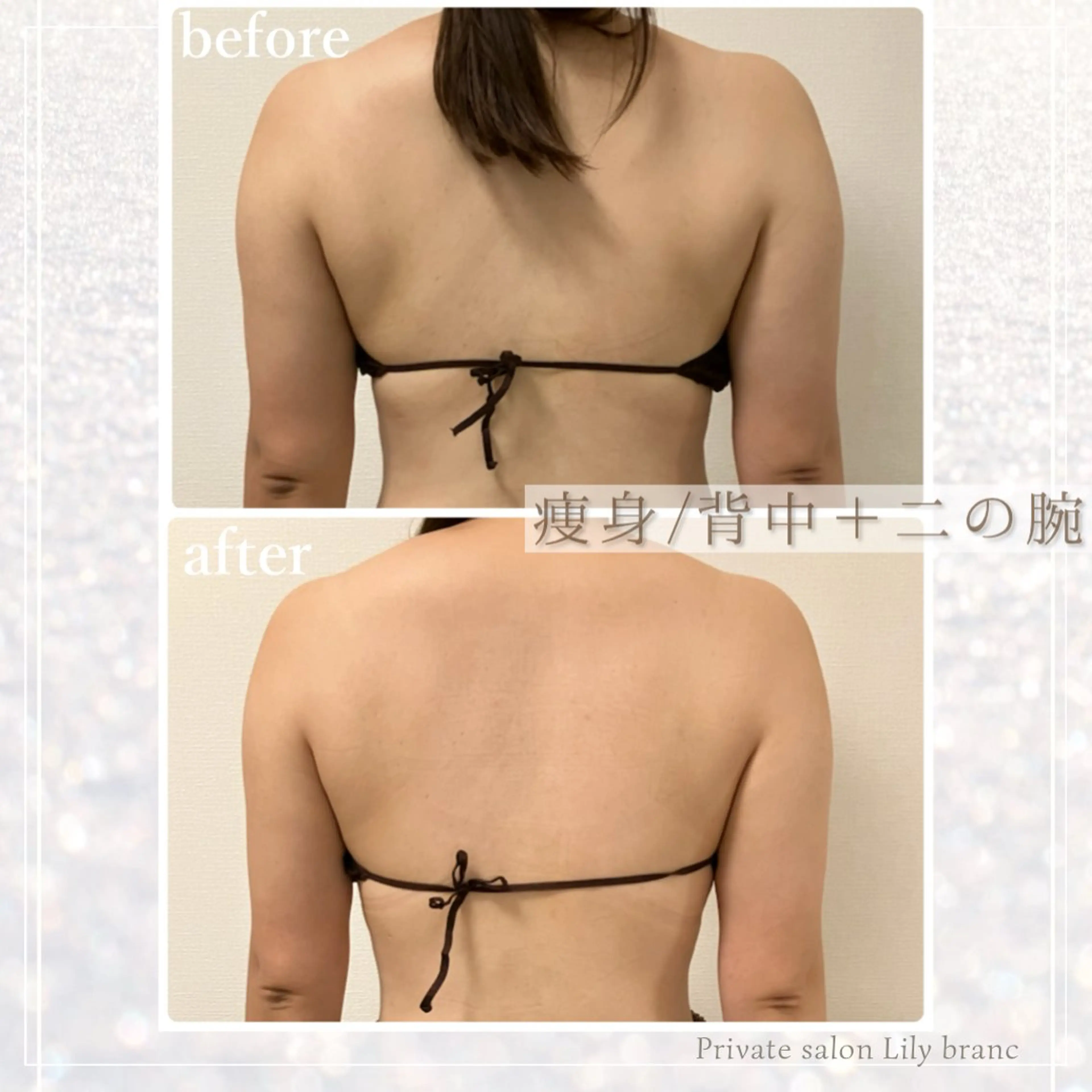 エステ Lily branc 痩身/小顔/肌質改善のエステ・リラクイメージ