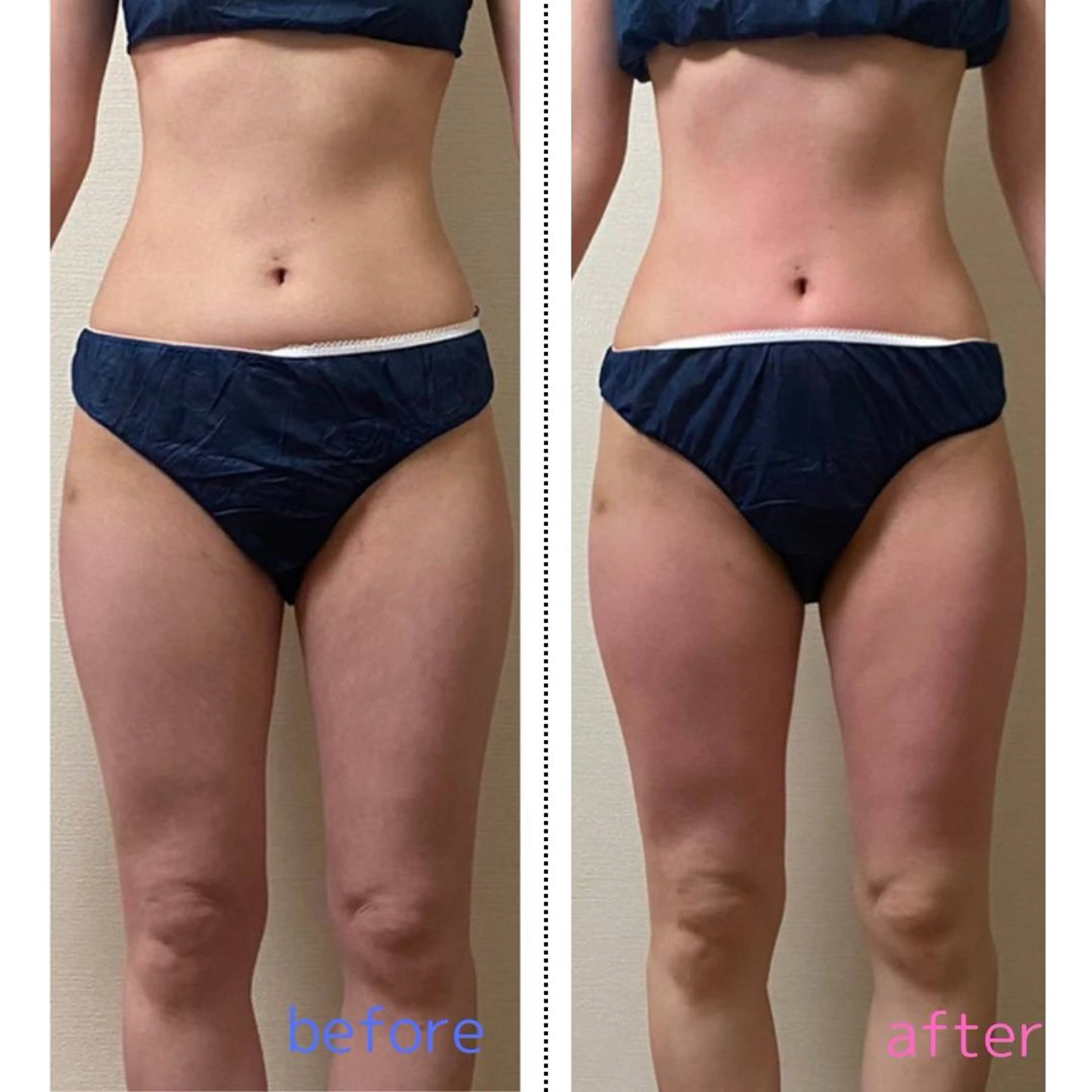 ACORAL痩身整体 NAZUKIのエステ・リラクイメージ