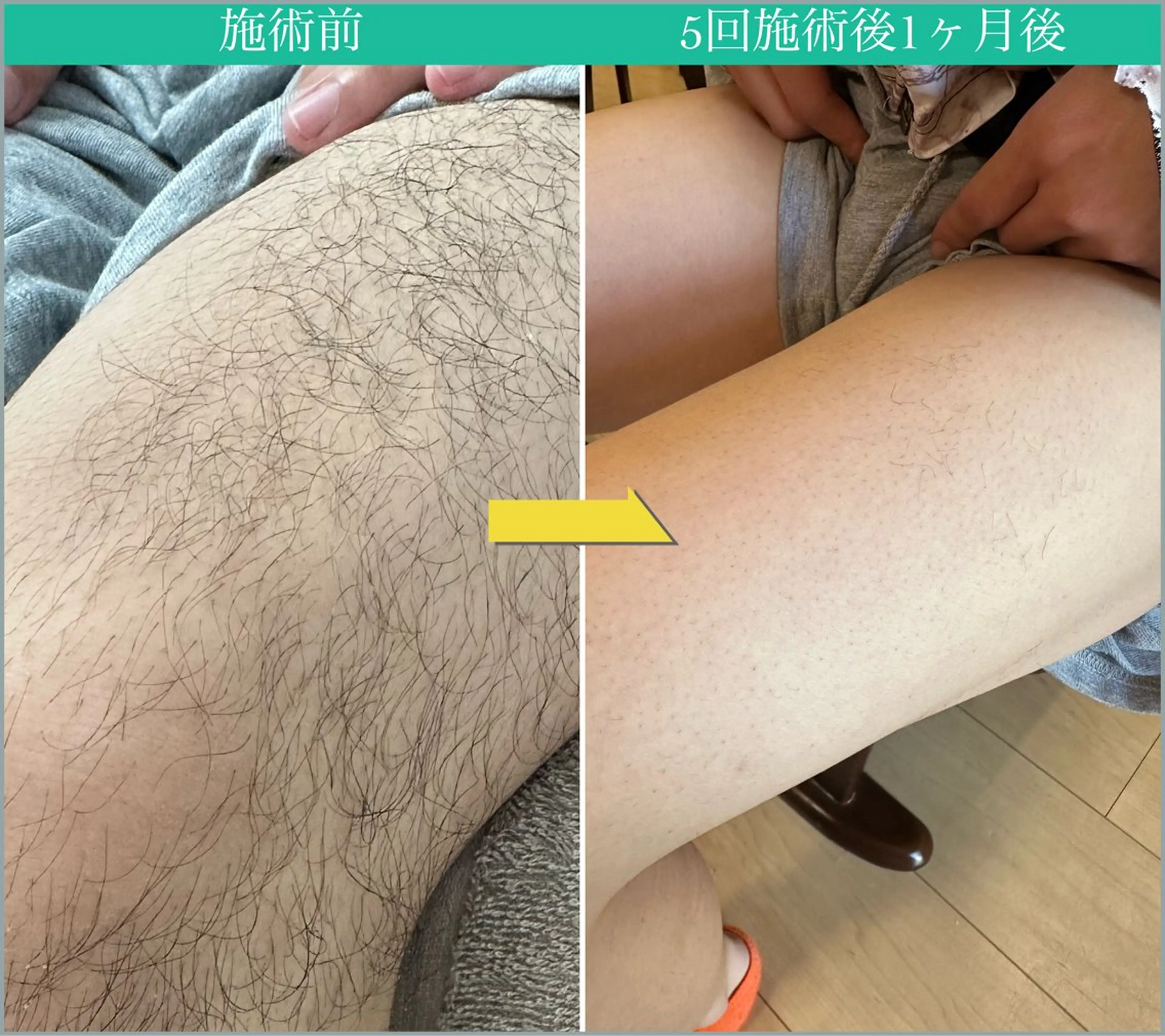 メンズ JONRY所属・JONRY （ジョンリー）のエステ・リラクイメージ