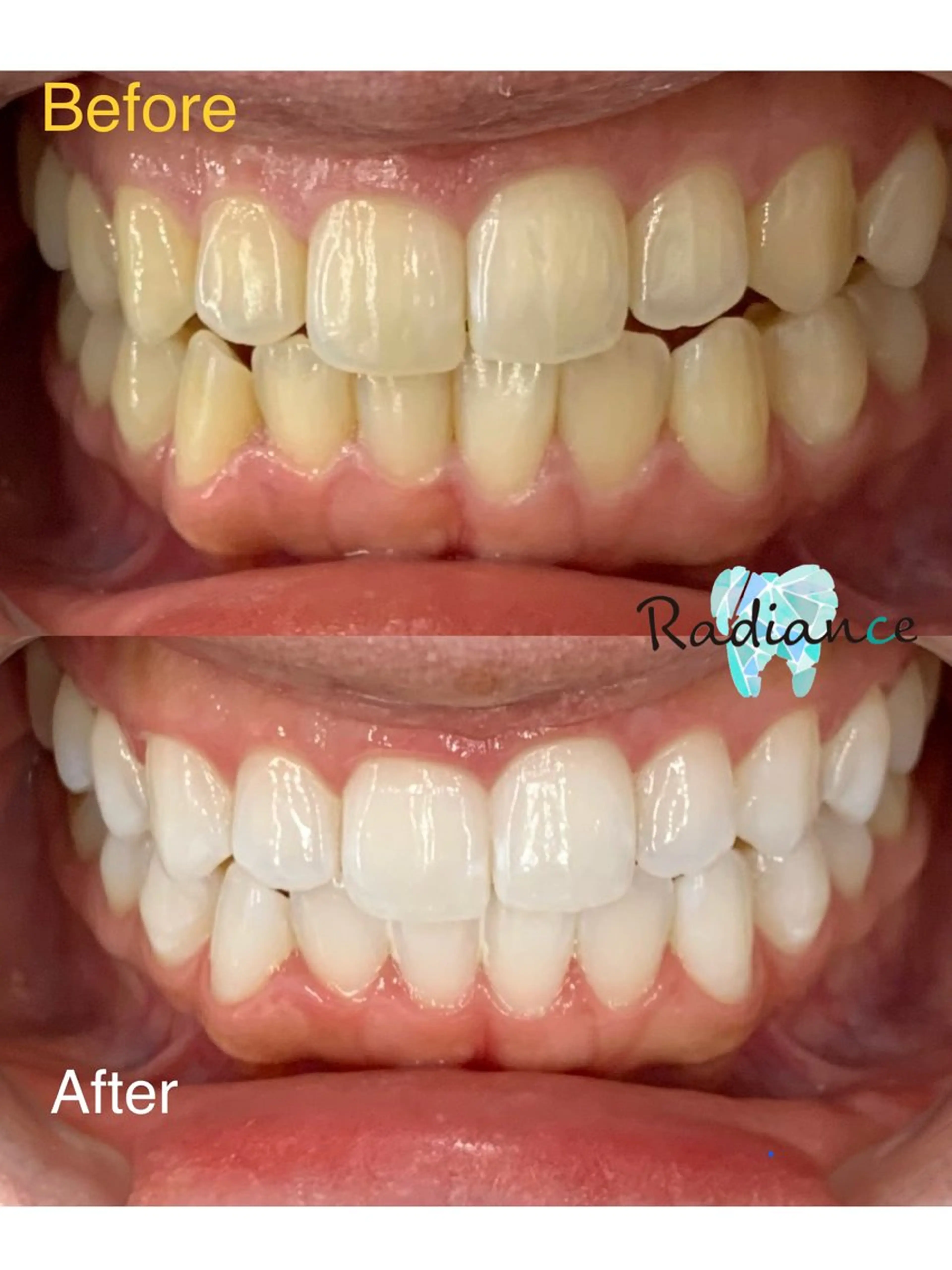 その他 札幌ホワイトニング ラディアンス札幌駅店のその他イメージ