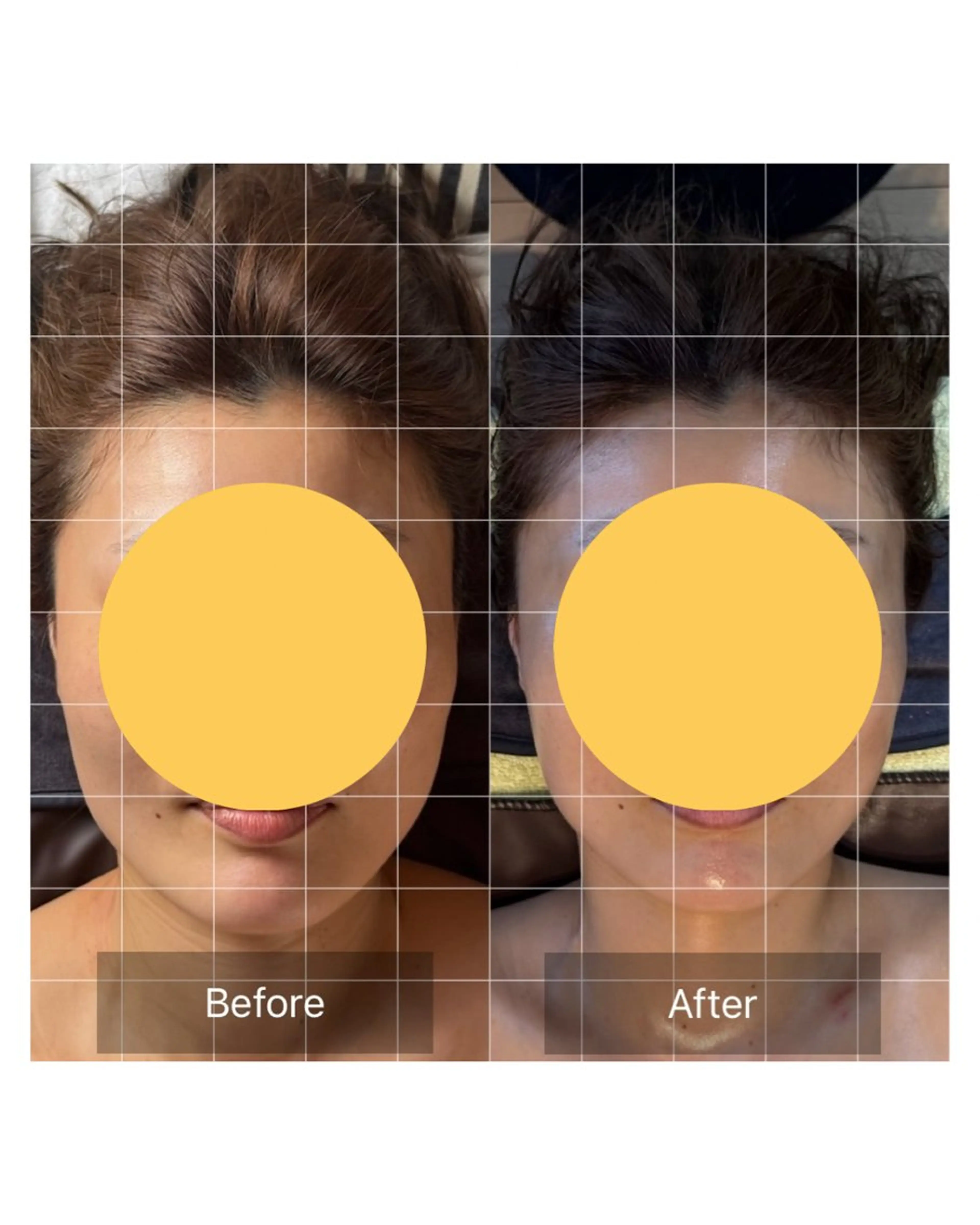 LANI所属・小顔専門サロン MAIのエステ・リラクイメージ