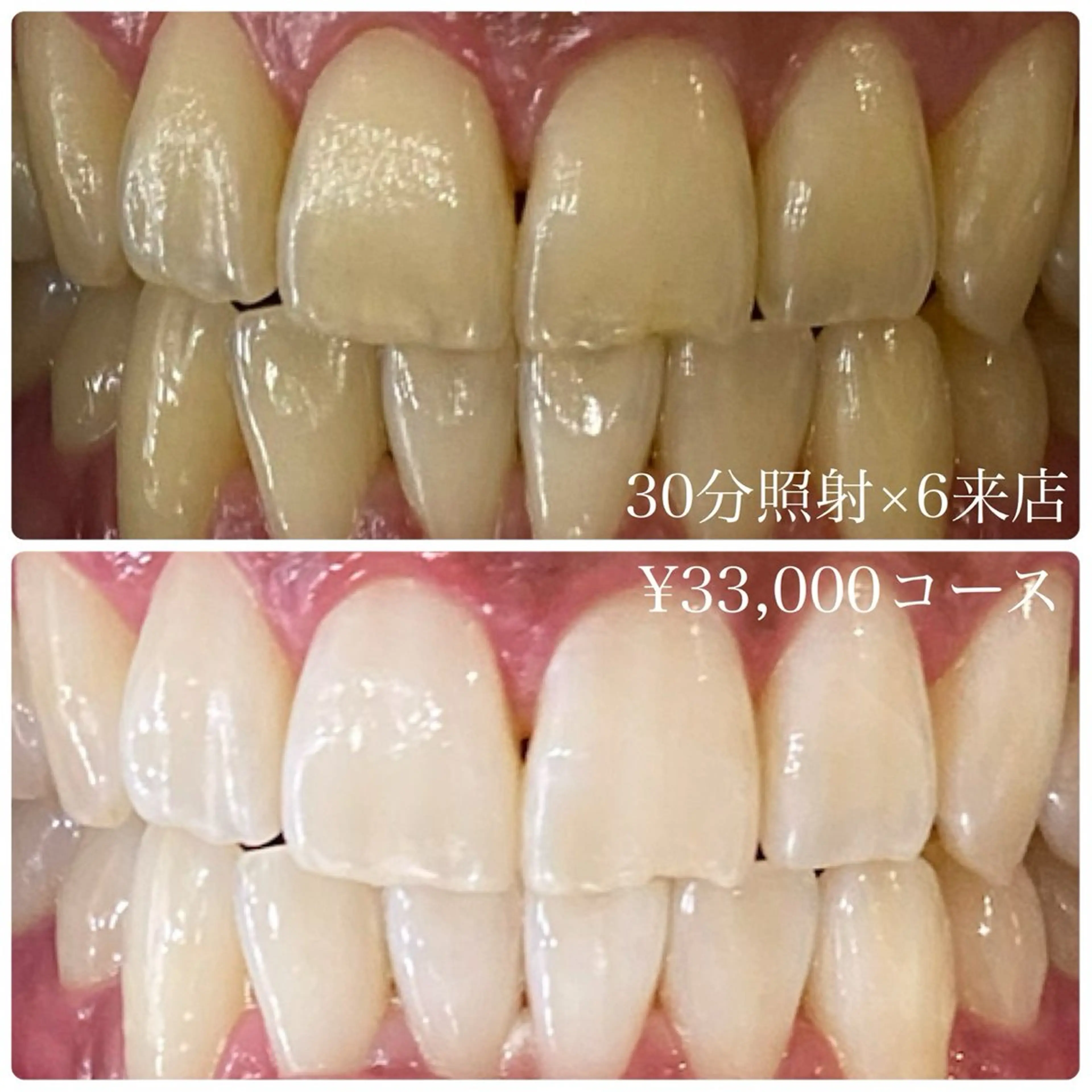 PLATINUM Beauty 横浜店所属・ホワイトニングルーム 横浜店のその他イメージ