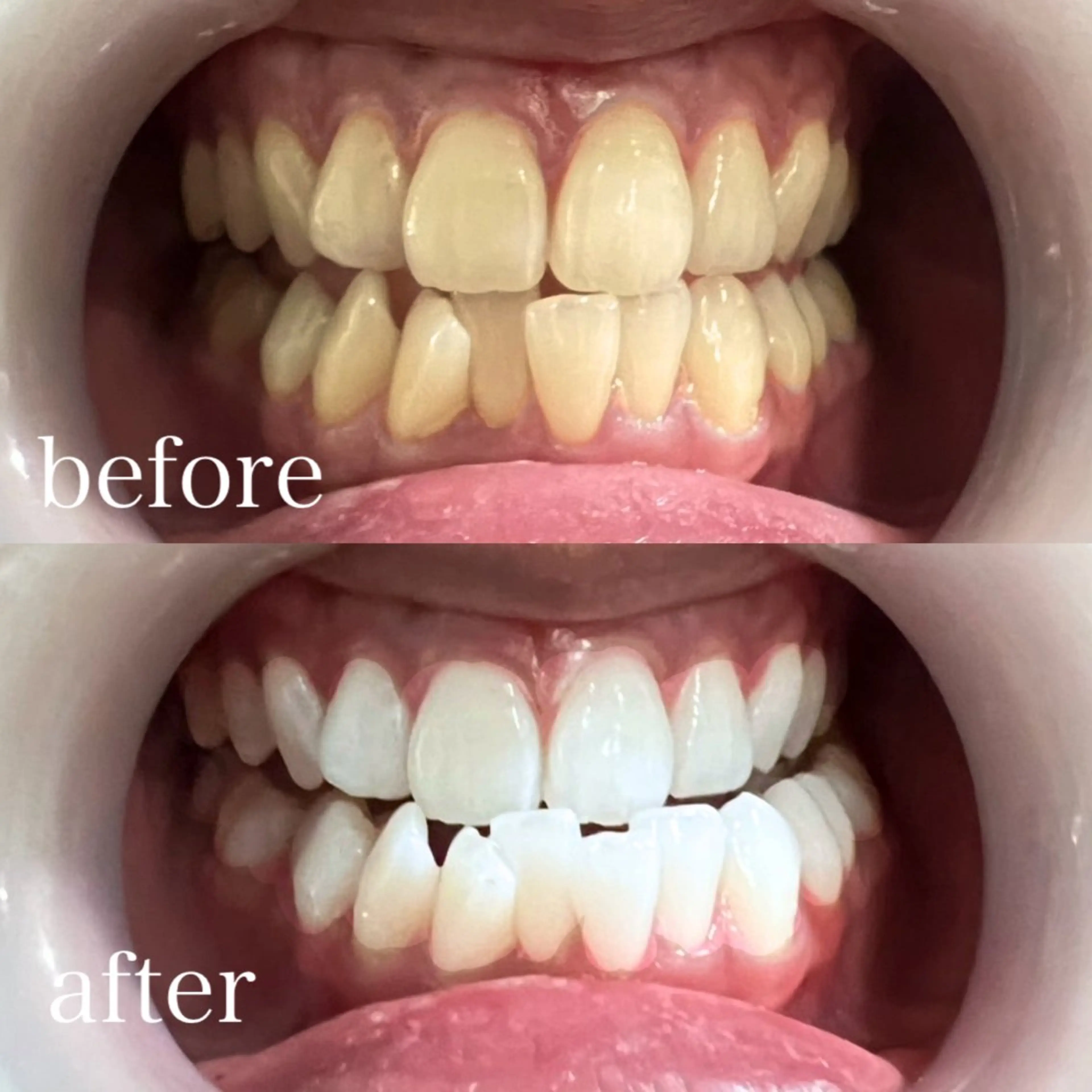 その他 ホワイトニング×肌質 改善~elエル~のその他イメージ