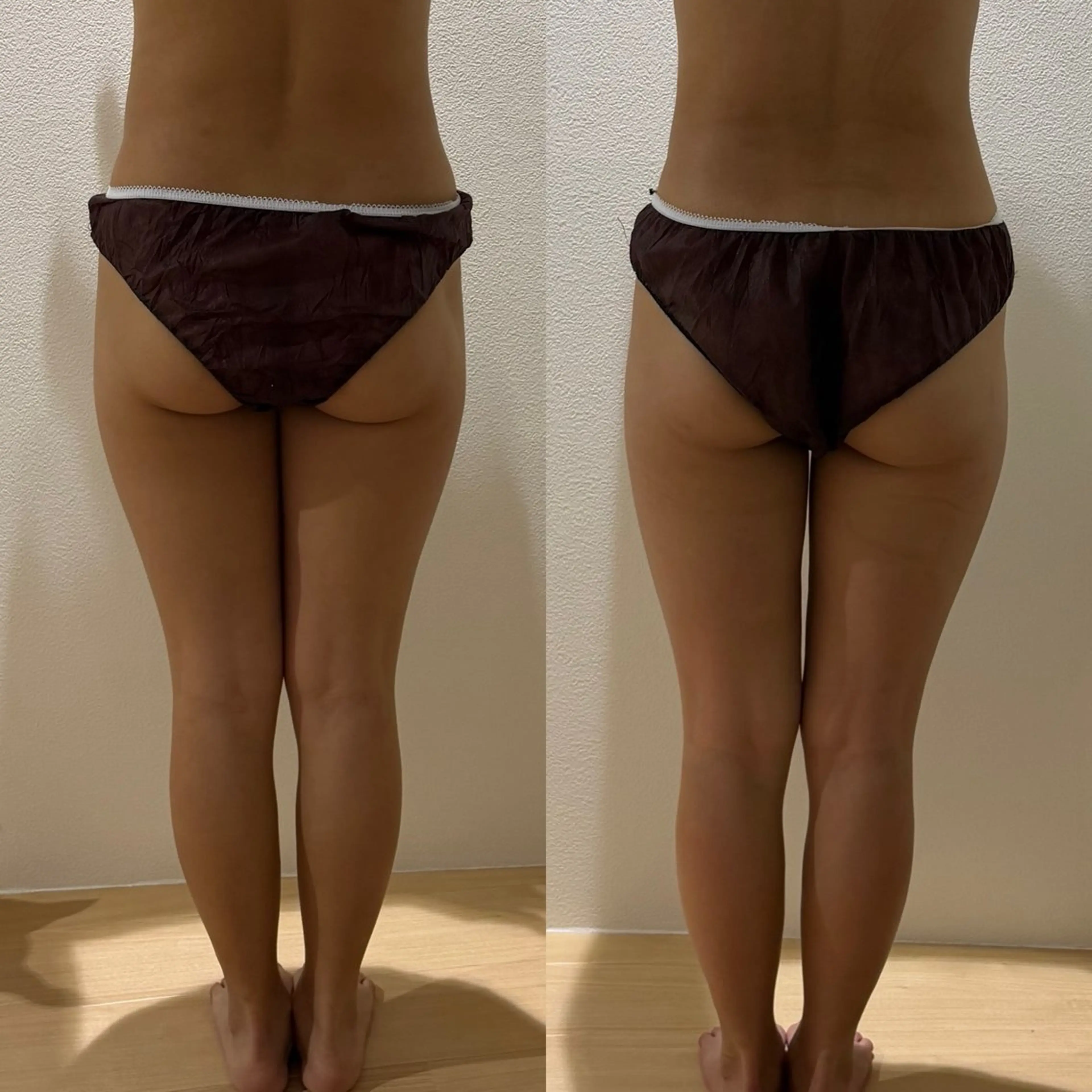 エステ リラク よもぎ蒸しサロンc.iエステティック所属・睡眠の質／体質改善 c.iエステティックのエステ・リラクイメージ