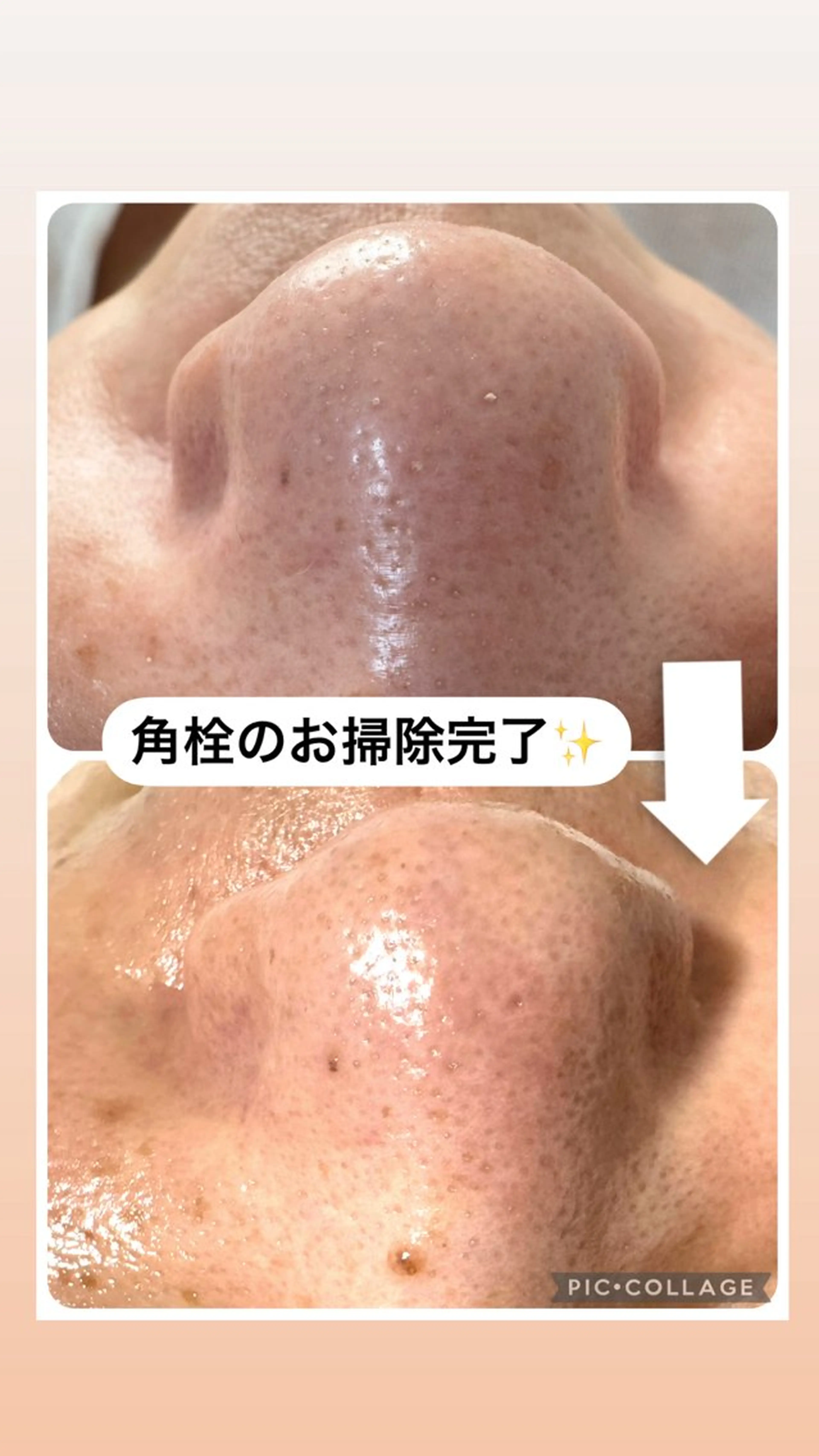 W MISATOのエステ・リラクイメージ