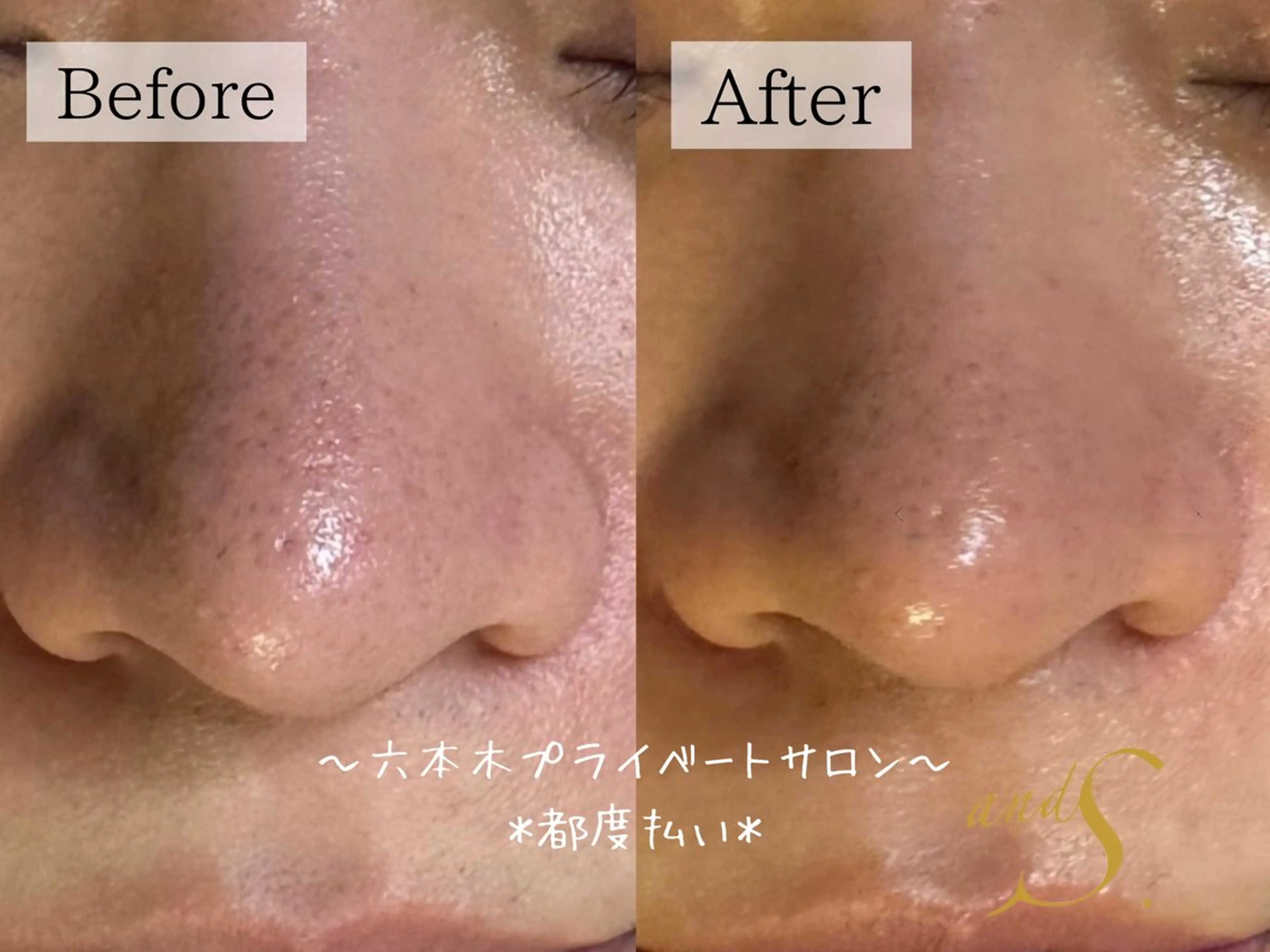 エステ 🌸🧡六本木 脱毛しずか🧡🫧の眉毛・アイブロウイメージ