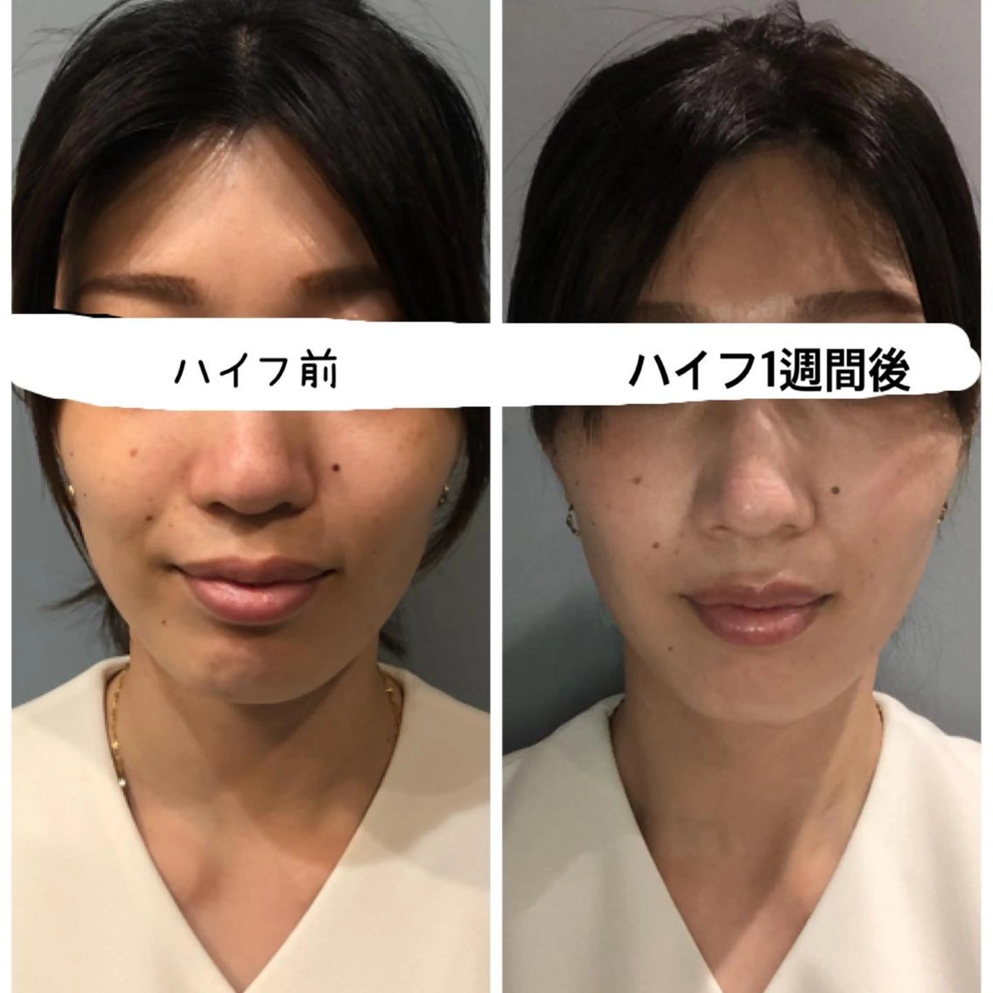 Rie a:Q久米川店のエステ・リラクイメージ