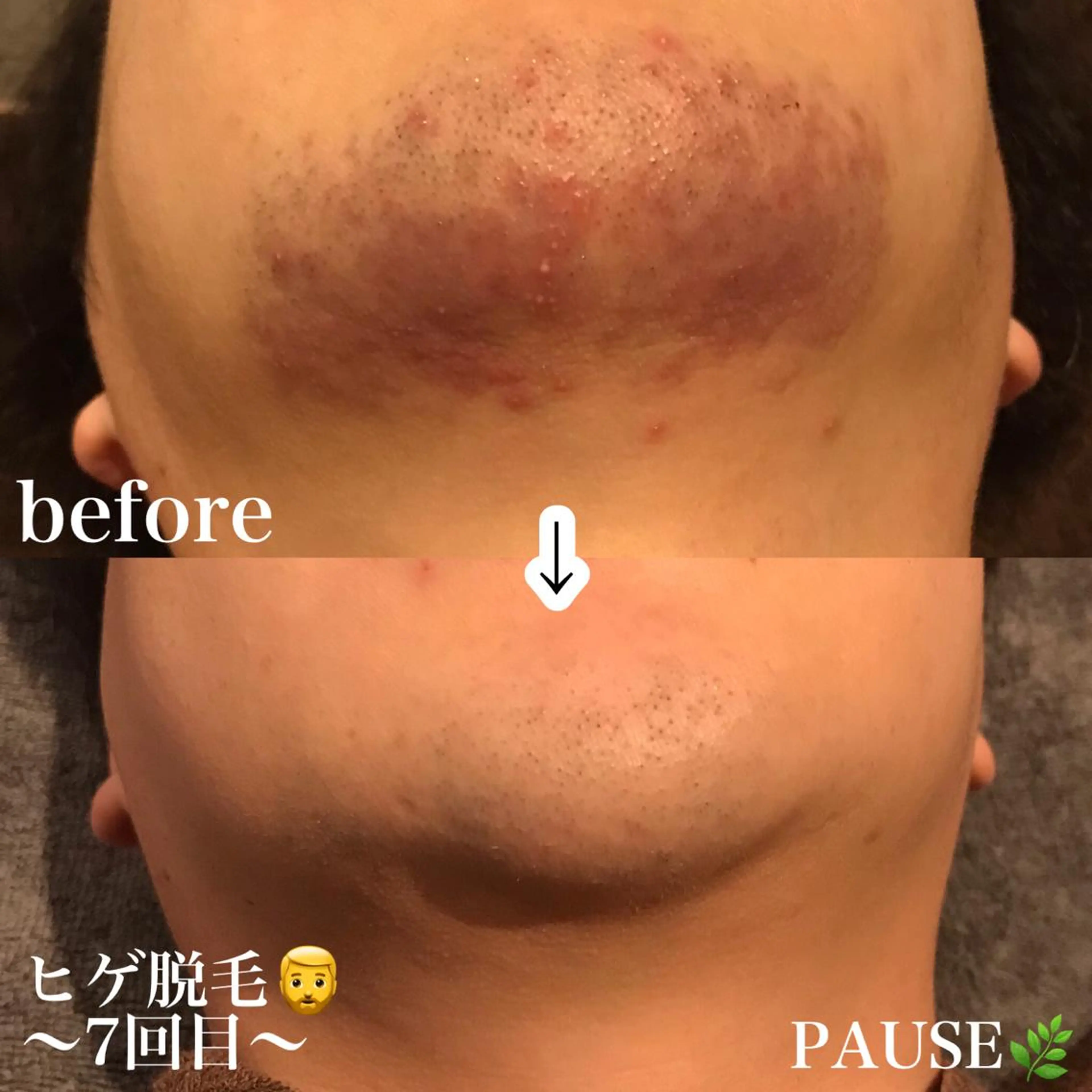 脱毛 浜野 恵美のエステ・リラクイメージ