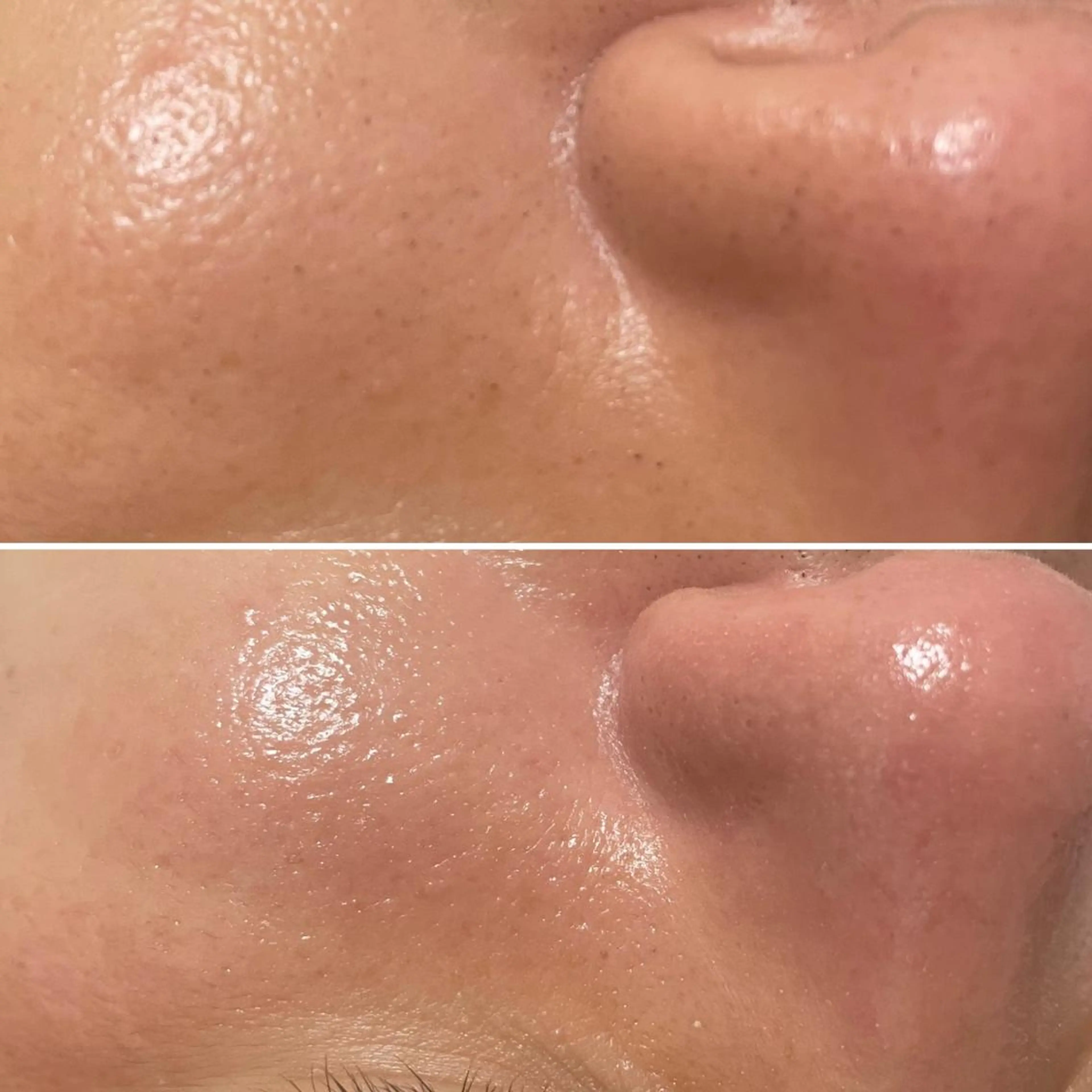 アイブロウ マツエク・マツパ キッズ メンズ Epina 千葉店 【エピナ】のエステ・リラクイメージ