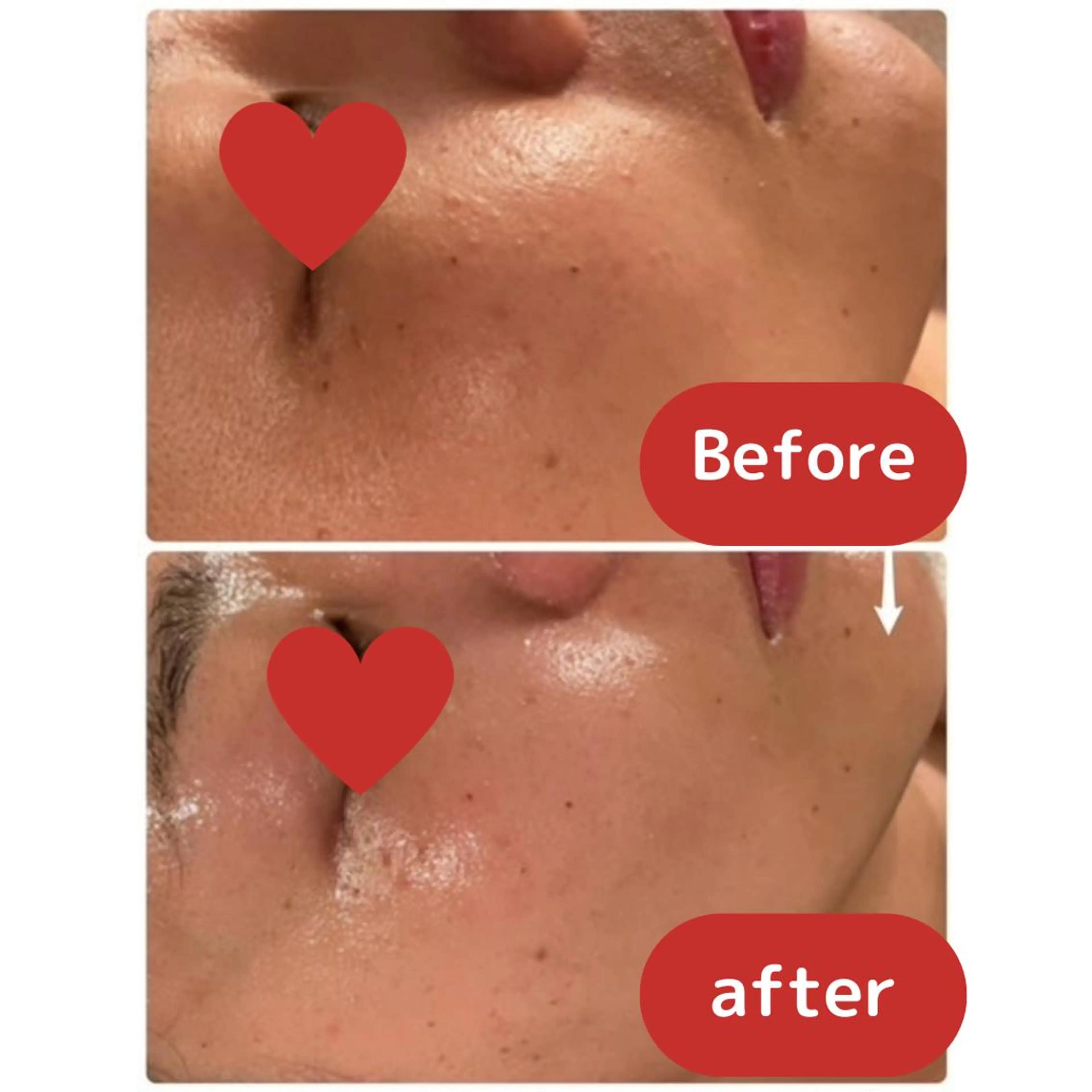 TWINKLE上尾店 Shimadaのエステ・リラクイメージ