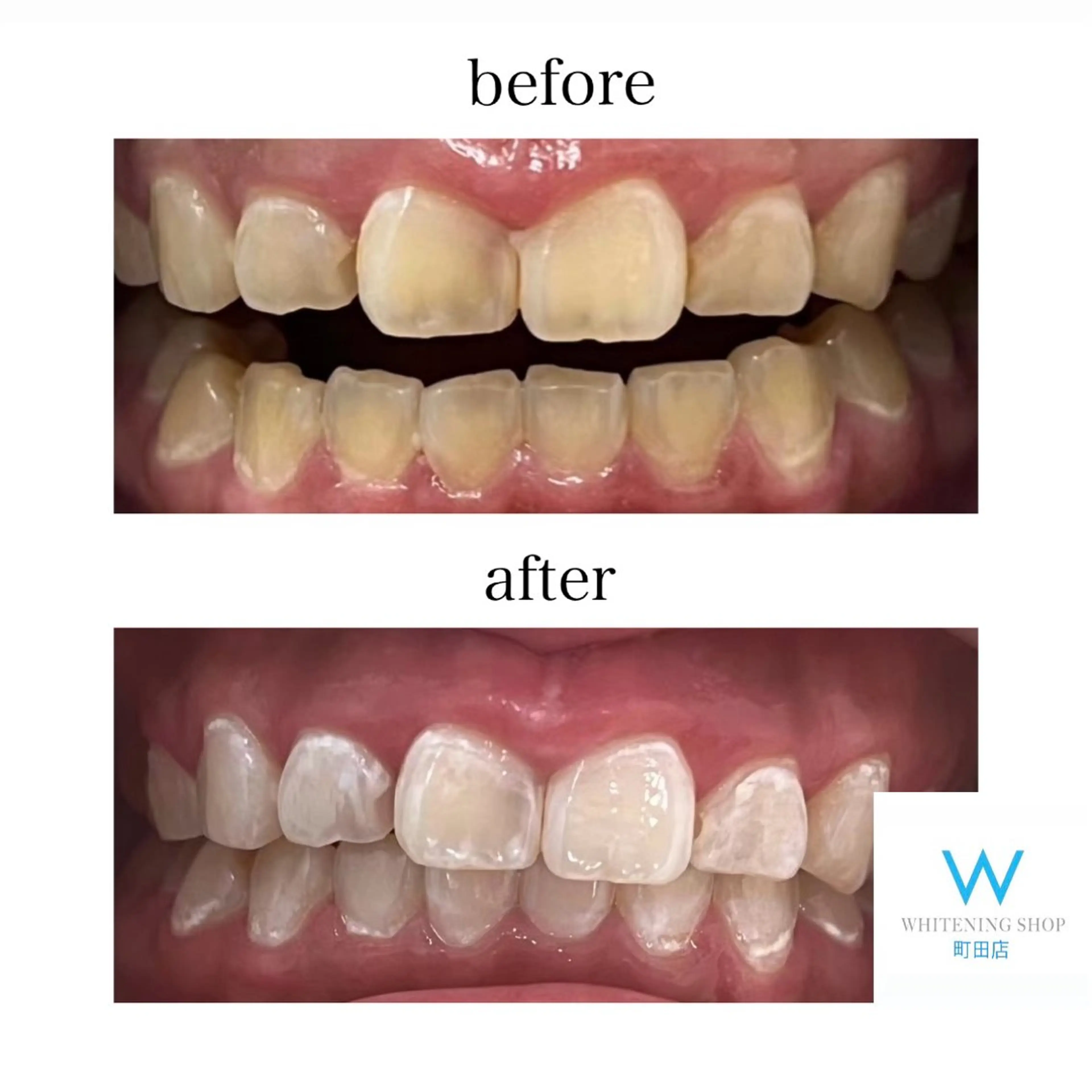 メンズ キッズ ホワイトニング ショップ町田店のその他イメージ