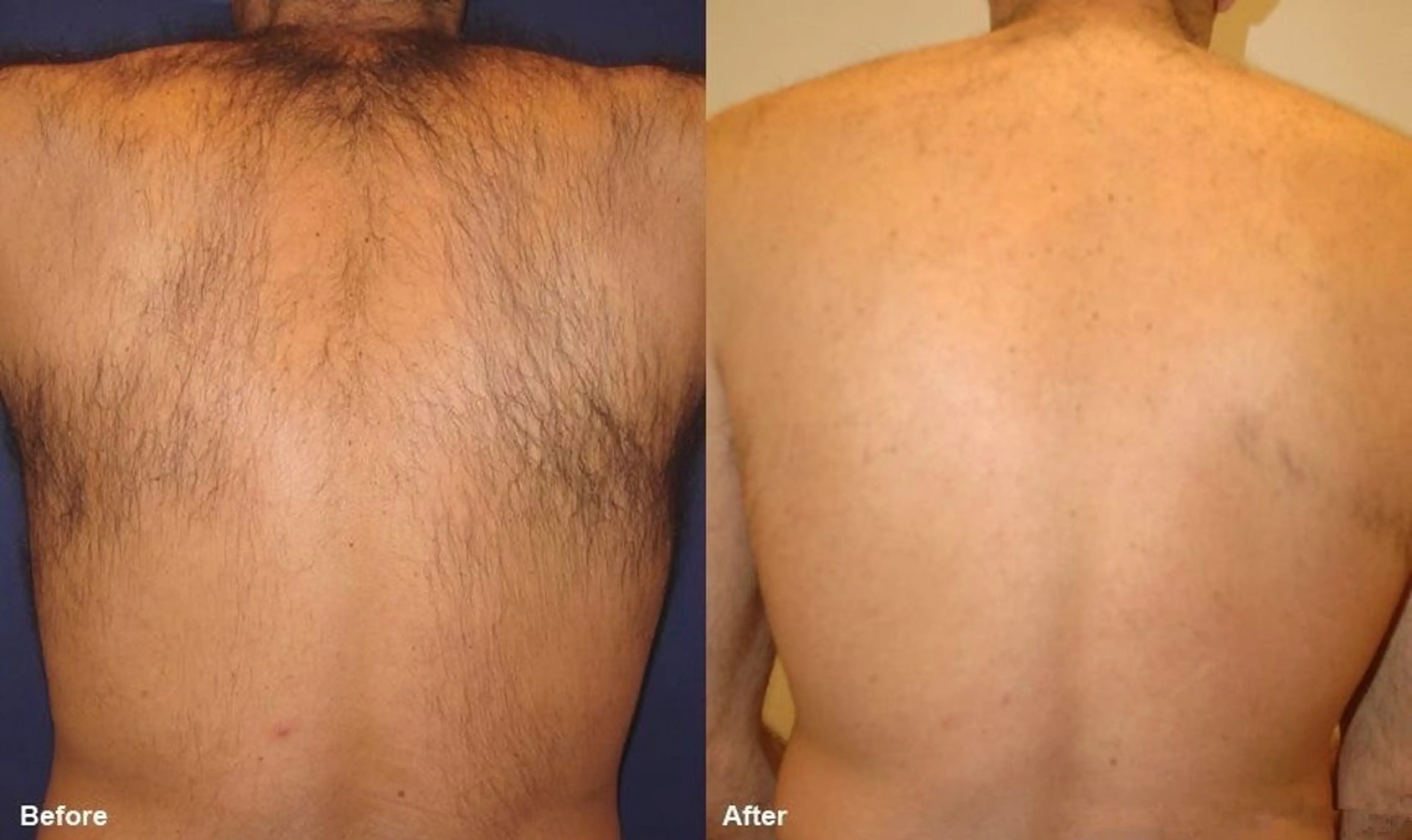 メンズ メンズ美肌脱毛 seekest.のエステ・リラクイメージ